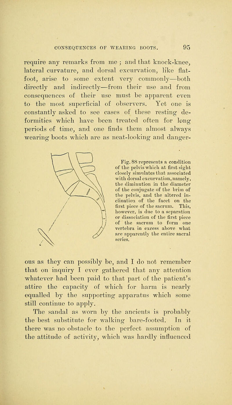 require any remarks from me ; and that knock-knee^ lateral curvature, and dorsal excurvation, like flat- foot, arise to some extent very commonly—both directly and indirectly—from their use and from consequences of their use must be apparent even to the most superficial of observers. Yet one is constantly asked to see cases of these resting de- formities which have been treated often for long periods of time, and one finds them almost always wearing boots which are as neat-looking and danger- Fig. 88 represents a condition of the pelvis which at first sight closely simulates that associated with dorsal excurvation,namely, the diminution in the diameter of the conjugate of the hrim of the pelvis, and the altered in- clination of the facet on the first piece of the sacrum. This, however, is due to a separation or dissociation of the first piece of the sacrum to form one vertebra in excess above what are apparently the entire sacral series. ous as they can possibly be, and I do not remember that on inquiry I ever gathered that any attention whatever had been paid to that part of the patient's attire the capacity of which for harm is nearly equalled by the supporting apparatus which some still continue to apply. The sandal as worn by the ancients is probably the best substitute for walking bare-footed. In it there was no obstacle to the perfect assumption of the attitude of activity, which was hardly influenced