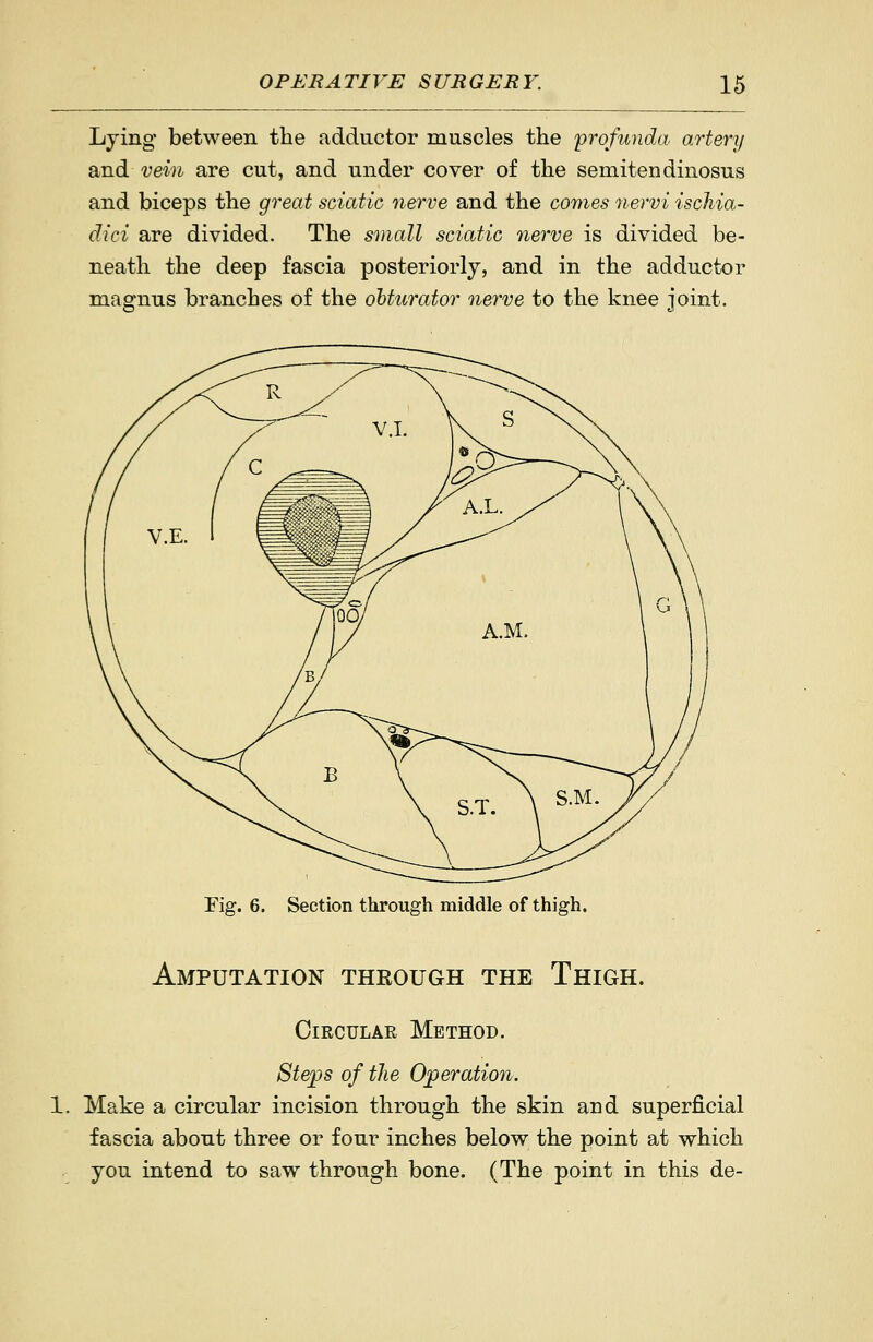 Lying between the adductor muscles the 'profunda artery and vem are cut, and under cover of the semitendinosus and biceps the great sciatic nerve and the comes nervi ischia- dici are divided. The small sciatic nerve is divided be- neath the deep fascia posteriorly, and in the adductor magnus branches of the obturator nerve to the knee joint. Fig. 6. Section through middle of thigh. Amputation through the Thigh. Circular Method. Steps of tJie Operation. 1. Make a circular incision through the skin and superficial fascia about three or four inches below the point at which you intend to saw through bone. (The point in this de-