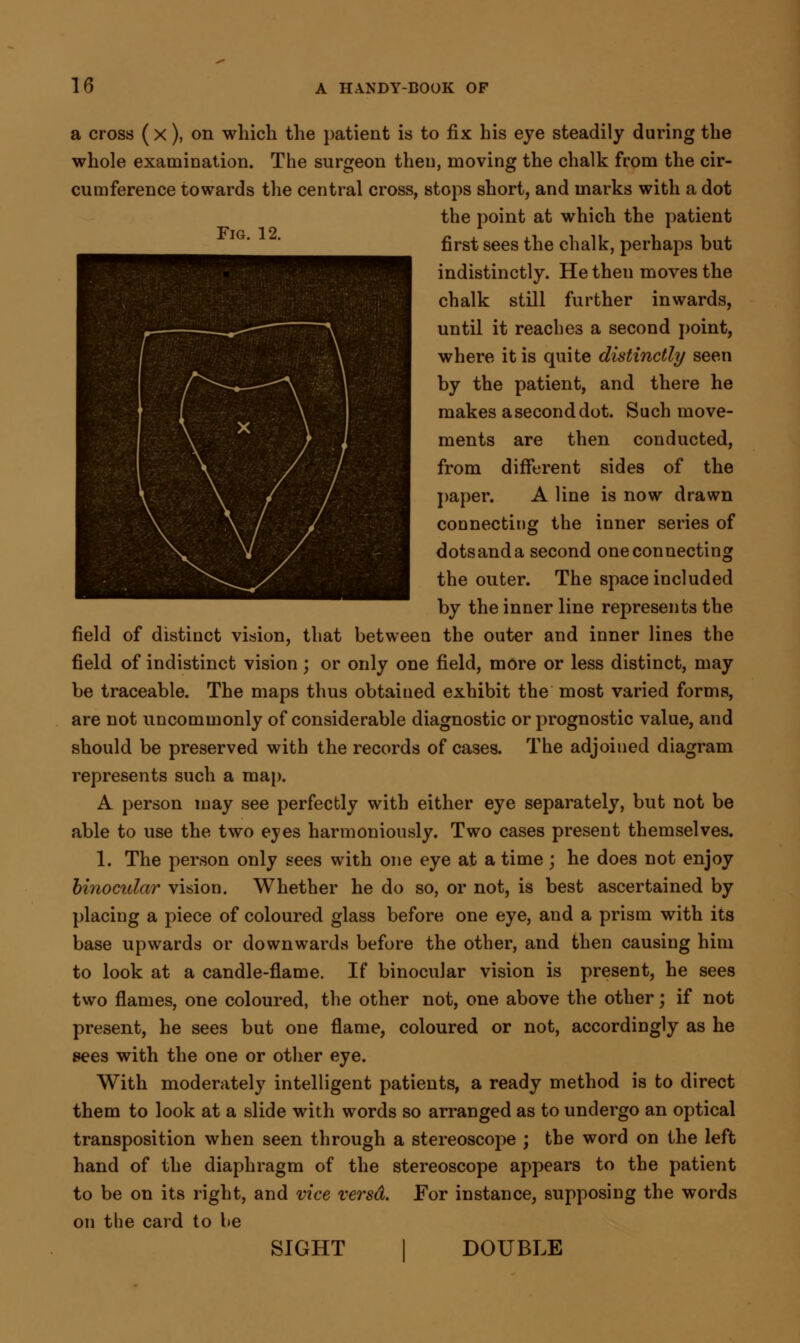 a cross (x), on which the patient is to fix his eye steadily during the whole examination. The surgeon then, moving the chalk from the cir- cumference towards the central cross, stops short, and marks with a dot the point at which the patient first sees the chalk, perhaps but indistinctly. He then moves the chalk still further inwards, until it reaches a second point, where it is quite distinctly seen by the patient, and there he makes a second dot. Such move- ments are then conducted, from different sides of the paper. A line is now drawn connecting the inner series of dotsanda second oneconnecting the outer. The space included by the inner line represents the field of distinct vision, that between the outer and inner lines the field of indistinct vision j or only one field, more or less distinct, may be traceable. The maps thus obtained exhibit the most varied forms, are not uncommonly of considerable diagnostic or prognostic value, and should be preserved with the records of cases. The adjoined diagram represents such a map. A person may see perfectly with either eye separately, but not be able to use the two eyes harmoniously. Two cases present themselves. 1. The person only sees with one eye at a time; he does not enjoy binocular vision. Whether he do so, or not, is best ascertained by placing a piece of coloured glass before one eye, and a prism with its base upwards or downwards before the other, and then causing him to look at a candle-flame. If binocular vision is present, he sees two flames, one coloured, the other not, one above the other; if not present, he sees but one flame, coloured or not, accordingly as he sees with the one or other eye. With moderately intelligent patients, a ready method is to direct them to look at a slide with words so arranged as to undergo an optical transposition when seen through a stereoscope ; the word on the left hand of the diaphragm of the stereoscope appears to the patient to be on its right, and vice versd. For instance, supposing the words on the card to he SIGHT I DOUBLE