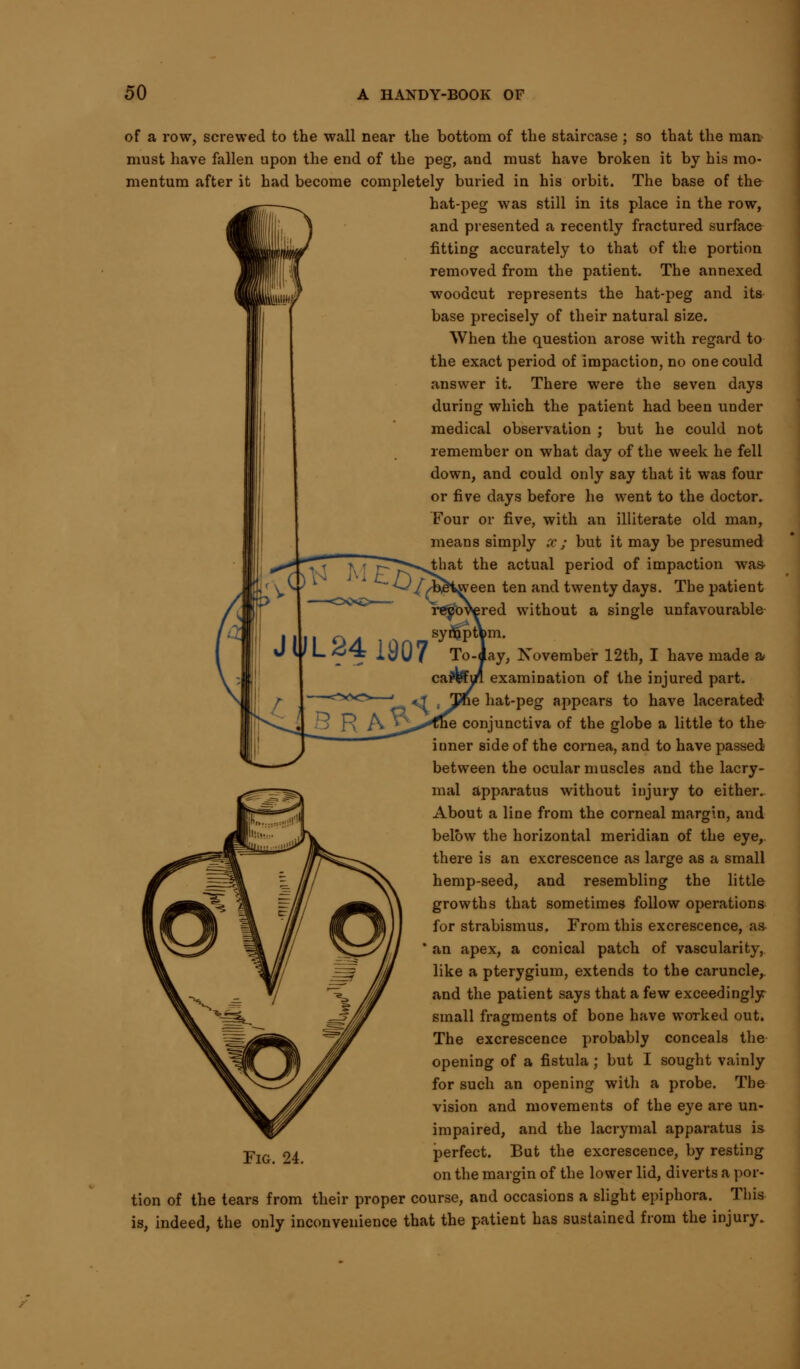 of a row, screwed to the wall near the bottom of the staircase ; so that the man must have fallen upon the end of the peg, and must have broken it by his mo- mentum after it had become completely buried in his orbit. The base of the hat-peg was still in its place in the row, and presented a recently fractured surface fitting accurately to that of the portion removed from the patient. The annexed woodcut represents the hat-peg and its base precisely of their natural size. When the question arose with regard to the exact period of impaction, no one could answer it. There were the seven days during which the patient had been under medical observation ; but he could not remember on what day of the week he fell down, and could only say that it was four or five days before he went to the doctor. Four or five, with an illiterate old man, means simply x; but it may be presumed the actual period of impaction was- iween ten and twenty days. The patient ;red without a single unfavourable symptcm. JUL <J4 1907 To-)ay, November 12th, I have made a examination of the injured part, hat-peg appears to have lacerated conjunctiva of the globe a little to the- inner side of the cornea, and to have passed between the ocular muscles and the lacry- mal apparatus without injury to either. About a line from the corneal margin, and below the horizontal meridian of the eye, there is an excrescence as large as a small hemp-seed, and resembling the little growths that sometimes follow operations for strabismus. From this excrescence, as an apex, a conical patch of vascularity, like a pterygium, extends to the caruncle, and the patient says that a few exceedingly small fragments of bone have worked out. The excrescence probably conceals the opening of a fistula; but I sought vainly for such an opening with a probe. The vision and movements of the eye are un- impaired, and the lacrymal apparatus is perfect. But the excrescence, by resting on the margin of the lower lid, diverts a por- tion of the tears from their proper course, and occasions a slight epiphora. This is, indeed, the only inconvenience that the patient has sustained from the injury. Fig. 24.