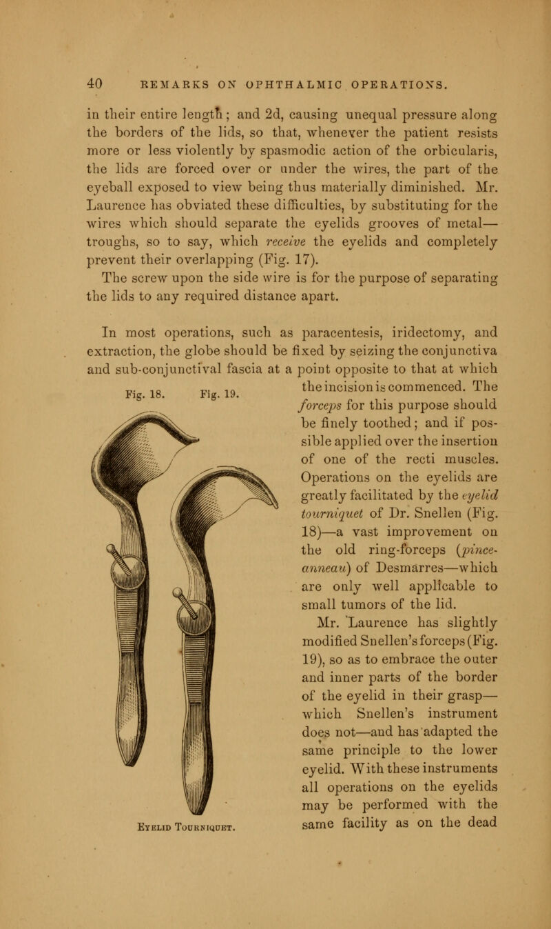 in their entire lengtn; and 2d, causing unequal pressure along the borders of the lids, so that, whenever the patient resists more or less violently by spasmodic action of the orbicularis, the lids are forced over or under the wires, the part of the eyeball exposed to view being thus materially diminished. Mr. Laurence has obviated these difficulties, by substituting for the wires which should separate the eyelids grooves of metal— troughs, so to say, which receive the eyelids and completely prevent their overlapping (Fig. 17). The screw upon the side wire is for the purpose of separating the lids to any required distance apart. Fig. 18. Fig. 19. In most operations, such as paracentesis, iridectomy, and extraction, the globe should be fixed by seizing the conjunctiva and sub-conjunctival fascia at a point opposite to that at which the incision is commenced. The forceps for this purpose should be finely toothed; and if pos- sible applied over the insertion of one of the recti muscles. Operations on the eyelids are greatly facilitated by the eyelid tourniquet of Dr. Snellen (Fig. 18)—a vast improvement on the old ring-forceps (pince- anneau) of Desmarres—which are only well applicable to small tumors of the lid. Mr. Laurence has slightly modified Snellen's forceps (Fig. 19), so as to embrace the outer and inner parts of the border of the eyelid in their grasp— which Snellen's instrument does not—and has adapted the same principle to the lower eyelid. With these instruments all operations on the eyelids may be performed with the lidTourniqdp same facility as on the dead