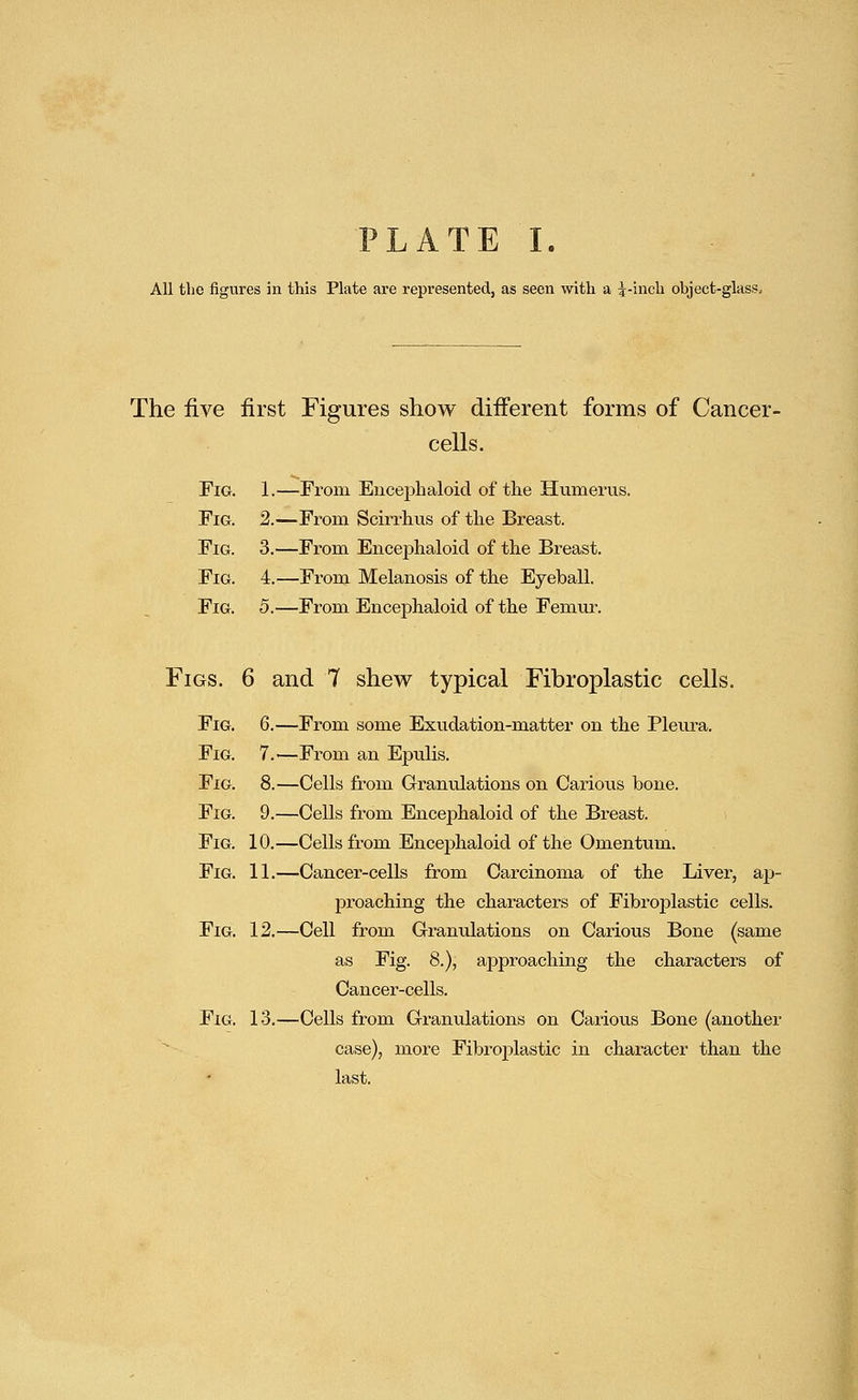 All tljc figures in this Plate are represented, as seen with a 4-inch object-gkss. The five first Figures show different forms of Cancer- cells. Fig. 1.—From Eiicej^haloid of the Humeiais. Fig. 2.—From Scirrhus of the Breast. Fig. 3.—From Encephaloid of the Breast. Fig. 4.—From Melanosis of the Eyeball. Fig. 5.—From Encephaloid of the Femui-. Figs. 6 and 7 shew typical Fibroplastic cells. Fig. 6.—From some Exudation-matter on the Pleura. Fig. 7.—From an Epulis. Fig. 8.—Cells from Granulations on Carious bone. Fig. 9.—Cells from Encephaloid of the Breast. Fig. 10.—Cells frora Encephaloid of the Omentum. Fig. 11.—Cancer-cells from Carcinoma of the Liver, ajj- proaching the characters of Fibroplastic cells. Fig. 12.—Cell from Granulations on Carious Bone (same as Fig. 8.), approaching the characters of Cancer-cells. Fig. 1-3.—Cells from Granulations on Carious Bone (another case), more Fibroplastic in character than the last.