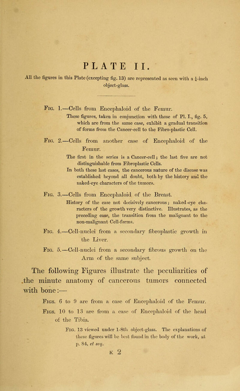 All the figures in tbis Plate (excepting fig. 13) are represented as seen with a i-iuch object-glass. Fig. 1.—Cells from Encephaloid of the Femur. These figures, taken in conjunction with those of PI. I., fig. 5, which are from the same case, exhibit a gradual transition of forms from the Cancer-cell to the Pibro-plastic Cell. Fig. 2.—Cells from another case of Encephaloid of the Femur. The first in the series is a Cancer-cell; the last five are not distinguishable from Fibroplastic Cells. In both these last cases, the cancerous nature of the disease was established beyond all doubt, both by the history and the naked-eye characters of the tumors. Fig. 3.—Cells from Encephaloid of the Breast. History of the case not decisively cancerous; naked-eye cha- racters of the growth very distinctive. Illustrates, as the preceding case, the transition from the malignant to the non-malignant Cell-forms. Fig. 4.—Cell-nuclei from a secondary fibroplastic gTowth in the Liver. Fig. 5.—Cell-nuclei from a secondary fibrous growth on the Arm of the same subject. The following Figures illustrate the peculiarities of .the minute anatomy of cancerous tumors connected with bone:— Figs. 6 to 9 are from a case of Encephaloid of the Femui*. Figs. 10 to 13 are fi-om a case of Encephaloid of the head of the Tibia. Fig. 13 viewed under l-8th object-glass. The explanations of these figures will be best found in the body of the work, at p. 84, et seq. K 2