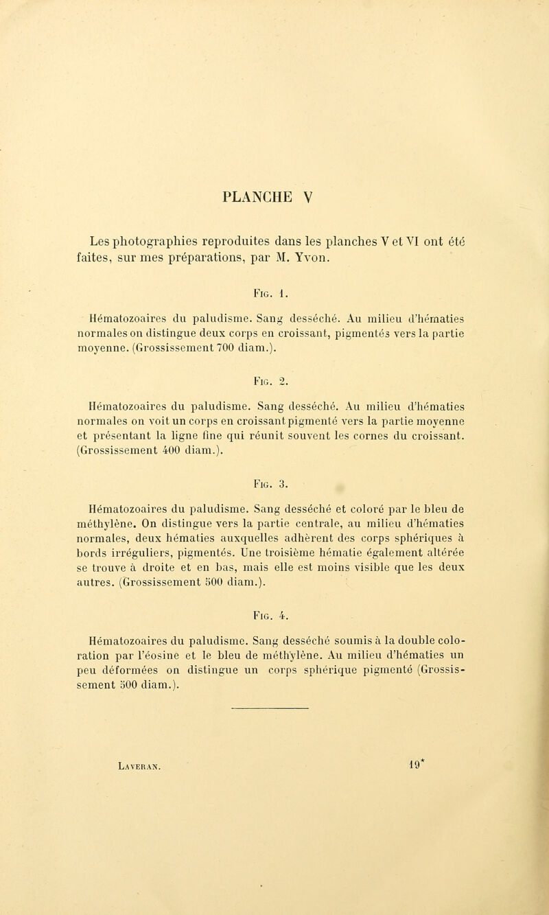 Les photographies reproduites dans les planches V et VI ont été faites, sur mes préparations, par M. Yvon. FiG. 1. Hématozoaires du paludisme. Sang desséché. Au milieu d'hématies normales on distingue deux corps en croissant, pigmentés vers la partie moyenne. (Grossissement 700 diam.). FiG. 2. Hématozoaires du paludisme. Sang desséché. Au milieu d'hématies normales on voit un corps en croissant pigmenté vers la partie moyenne et présentant la ligne fine qui réunit souvent les cornes du croissant. (Grossissement 400 diam.). FiG. 3. Hématozoaires du paludisme. Sang desséché et coloré par le bleu de méthylène. On distingue vers la partie centrale, au milieu d'hématies normales, deux hématies auxquelles adhèrent des corps sphériques à bords irréguliers, pigmentés. Une troisième hématie également altérée se trouve à droite et en bas, mais elle est moins visible que les deux autres. (Grossissement 500 diam.). FiG. 4. Hématozoaires du paludisme. Sang desséché soumis à la double colo- ration par l'éosine et le bleu de méthylène. Au milieu d'hématies un peu déformées on distingue un corps sphérique pigmenté (Grossis- sement 300 diam.). Laveran. 19