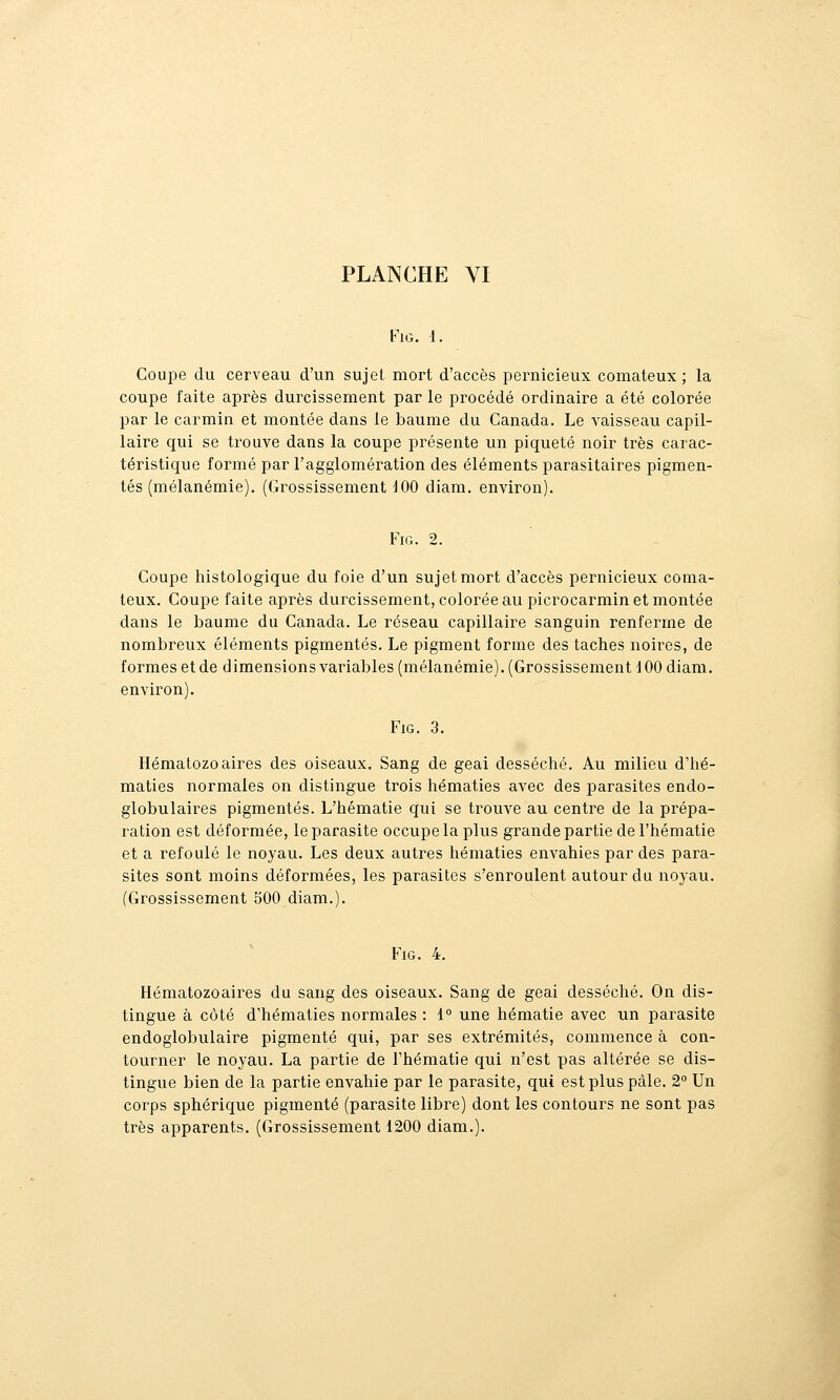 FlG. 1. Coupe du cerveau d'un sujet mort d'accès pernicieux comateux ; la coupe faite après durcissement par le procédé ordinaire a été colorée par le carmin et montée dans le baume du Canada. Le vaisseau capil- laire qui se trouve dans la coupe présente un piqueté noir très carac- téristique formé par l'agglomération des éléments parasitaires pigmen- tés (mélanémie). (Grossissement 100 diam. environ). FiG. 2. Coupe histologique du foie d'un sujet mort d'accès pernicieux coma- teux. Coupe faite api^ès durcissement, colorée au picrocarmin et montée dans le baume du Canada. Le réseau capillaire sanguin renferme de nombreux éléments pigmentés. Le pigment forme des taches noires, de formes et de dimensions variables (mélanémie). (Grossissement i 00 diam. environ). FiG. 3. Hématozoaires des oiseaux. Sang de geai desséché. Au milieu d'hé- maties normales on distingue trois hématies avec des parasites endo- globulaires pigmentés. L'hématie qui se trouve au centre de la prépa- ration est déformée, le parasite occupe la plus grande partie de l'hématie et a refoulé le noyau. Les deux autres hématies envahies par des para- sites sont moins déformées, les parasites s'enroulent autour du noyau. (Grossissement 500 diam.). FiG. 4. Hématozoaires du sang des oiseaux. Sang de geai desséché. On dis- tingue à côté d'hématies normales : 1° une hématie avec un parasite endoglobulaire pigmenté qui, par ses extrémités, commence à con- tourner le noyau. La partie de l'hématie qui n'est pas altérée se dis- tingue bien de la partie envahie par le parasite, qui est plus pâle. 2° Un corps sphérique pigmenté (parasite libre) dont les contours ne sont pas très apparents. (Grossissement 1200 diam.).