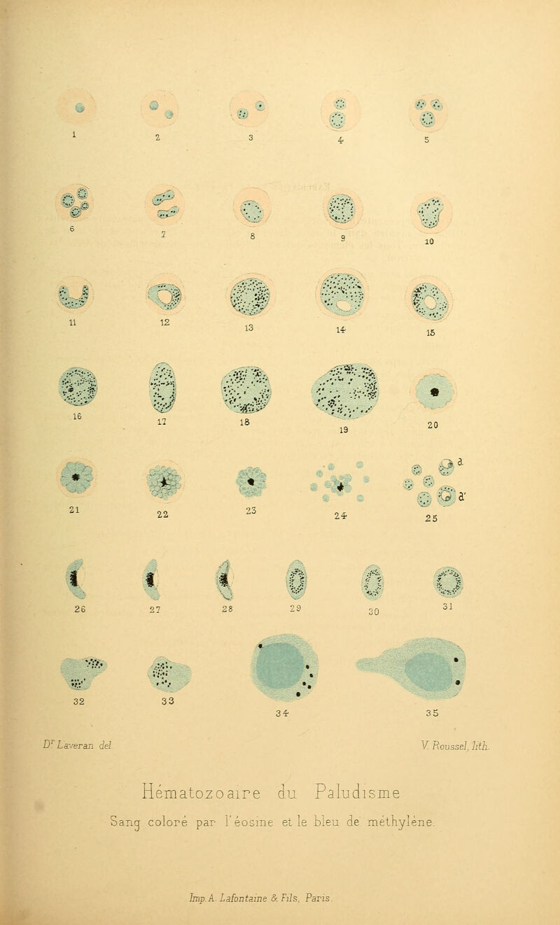 0^ 1 %sf £#^ ^%#^ ^j^sbi^s^:,- 11 12 —: 13 14- ^^ /#* ^Tî^P^ '••'*. , «Jt^ ,' '-^ • < r. *'.: •'î'*XV •■?:•• >n- 's ,..-:f?- ' '-'^ *' •■.'*! =-^'•*•. ■>•■';# -!::• y <îié-:-J 16 12 18 ■^'ssm^' 21 22 23 19 24 •*'.'■ ■;■. 15 20 éè^ i0 25 26 27 28 .^â 29 30 Vsvv 32 D^ Laveran del 33 34' 35 V Roussel. Iith. Hématozoaire du Paludisme Sang coloré par l'éosme elle bleu de méthylène. ïmp.k. Lafontaine & Fils, Paris.