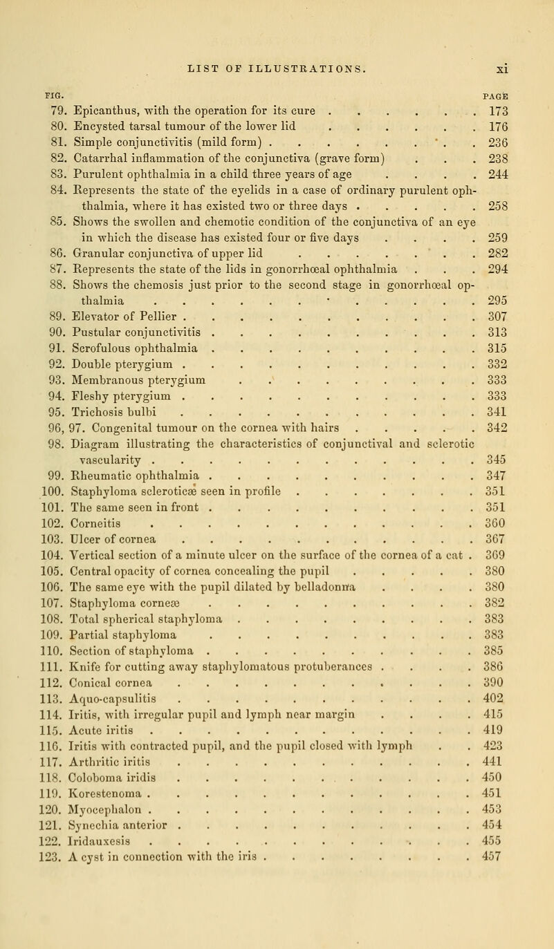 FIG. PAGE 79. Epicanthus, with the operation for its cure . . 173 80. Encysted tarsal tumour of the lower lid 176 81. Simple conjunctivitis (mild form)  . . 236 82. Catarrhal inflammation of the conjunctiva (grave form) . . . 238 83. Purulent ophthalmia in a child three years of age .... 244 84. Represents the state of the eyelids in a case of ordinary purulent oph- thalmia, where it has existed two or three days 258 85. Shows the swollen and chemotic condition of the conjunctiva of an eye in which the disease has existed four or five days .... 259 86. Granular conjunctiva of upper lid . 282 87. Represents the state of the lids in gonorrhoeal ophthalmia . . . 294 88. Shows the chemosis just prior to the second stage in gonorrhoeal op- thalmia * 295 89. Elevator of Pellier 307 90. Pustular conjunctivitis . . . . . . . . . . 313 91. Scrofulous ophthalmia 315 92. Double pterygium 332 93. Membranous pterygium 333 94. Fleshy pterygium 333 95. Trichosis bulbi 341 96. 97. Congenital tumour on the cornea with hairs ..... 342 98. Diagram illustrating the characteristics of conjunctival and sclerotic vascularity 345 99. Rheumatic ophthalmia 347 100. Staphyloma sclerotica^ seen in profile 351 101. The same seen in front 351 102. Corneitis 360 103. Ulcer of cornea 367 104. Vertical section of a minute ulcer on the surface of the cornea of a cat . 369 105. Central opacity of cornea concealing the pupil ..... 380 106. The same eye with the pupil dilated by belladonna .... 380 107. Staphyloma corneas 382 108. Total spherical staphyloma 383 109. Partial staphyloma 383 110. Section of staphyloma 385 111. Knife for cutting away staphylomatous protuberances .... 386 112. Conical cornea 390 113. Aquo-capsulitis 402 114. Iritis, with irregular pupil and lymph near margin .... 415 115. Acute iritis 419 116. Iritis with contracted pupil, and the pupil closed with lymph . . 423 117. Arthritic iritis 441 118. Coloboma iridis 450 119. Korestenoma 451 120. Myocephalon 453 121. Synechia anterior 454 122. Iridauxesis 455 123. A cyst in connection with the iris 457