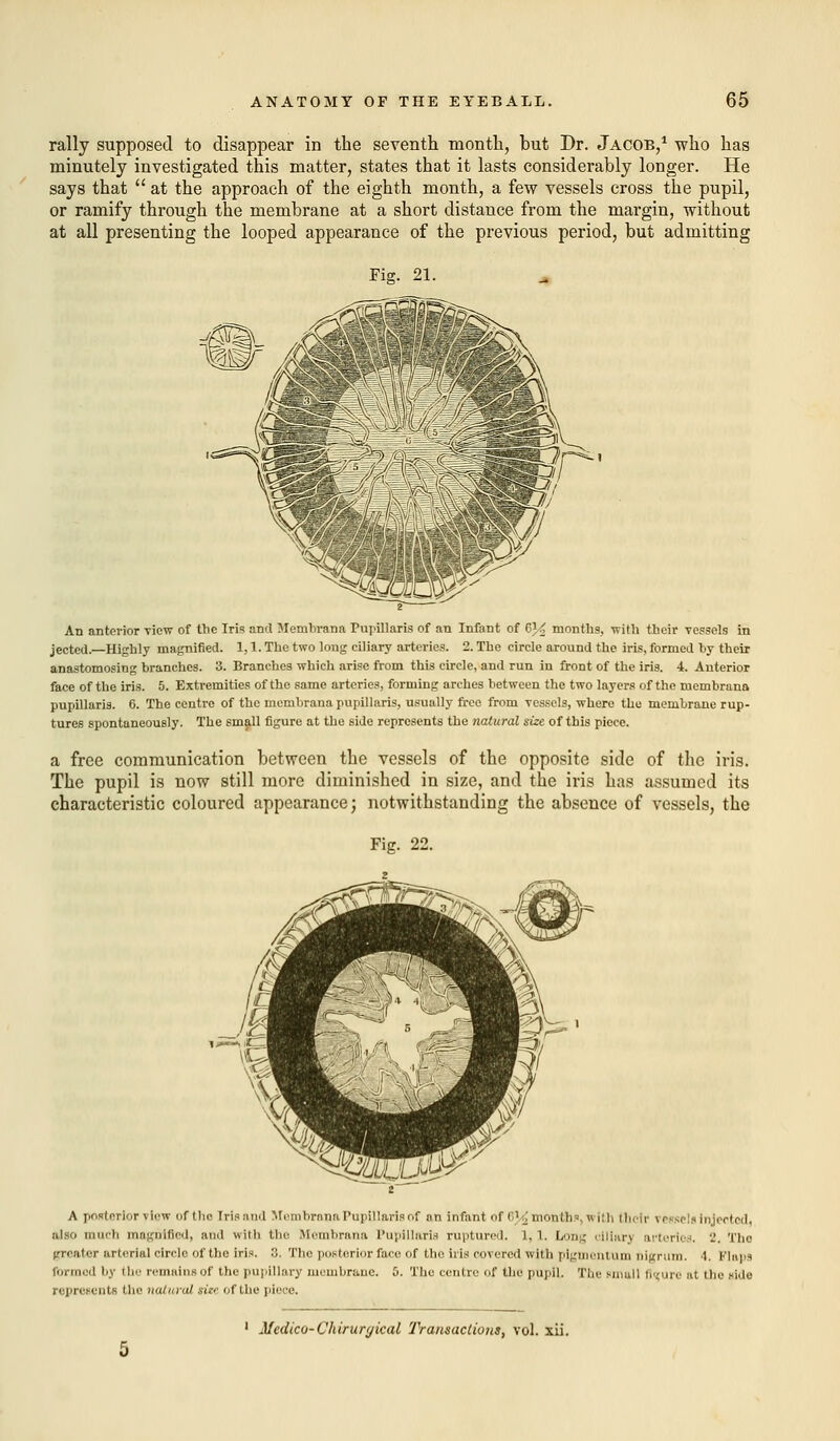 rally supposed to disappear in the seventh month, hut Dr. Jacob,1 who has minutely investigated this matter, states that it lasts considerably longer. He says that  at the approach of the eighth month, a few vessels cross the pupil, or ramify through the membrane at a short distance from the margin, without at all presenting the looped appearance of the previous period, but admitting Fie. 21. An anterior -view of the Iris anil Membrana Pupillaris of an Infant of 6}4 months, with their vessels in jected.— Highly magnified. 1,1. The two long ciliary arteries. 2. The circle around the iris, formed by their anastomosing branches. 3. Branches which arise from this circle, and run in front of the iris. 4. Anterior face of the iris. 5. Extremities of the same arteries, forming arches between the two layers of the membrana pupillaris. 6. The centre of the membrana pupillaris, usually free from vessels, where the membrane rup- tures spontaneously. The small figure at the side represents the natural size of this piece. a free communication between the vessels of the opposite side of the iris. The pupil is now still more diminished in size, and the iris has assumed its characteristic coloured appearance; notwithstanding the absence of vessels, the A posterior view of t lie Iris :i tn I Membrana Pupillaris of an infant of GVJ months, wi!h their vessels injected, also much magnified, and with the Membrana Papillaris ruptured. 1,1. Long ciliary arteries. 2, The greater arterial circle of the iris. 3. The posterior face of the iris covered with pigmentum nigrum. 1. Flaps formed by the remains of the pupillary membrane. 5. The centre of the pupil. The small figure ai the aide represents the natural site of the pioce. 1 Medico-Chirurgical Transactions, vol. xii.
