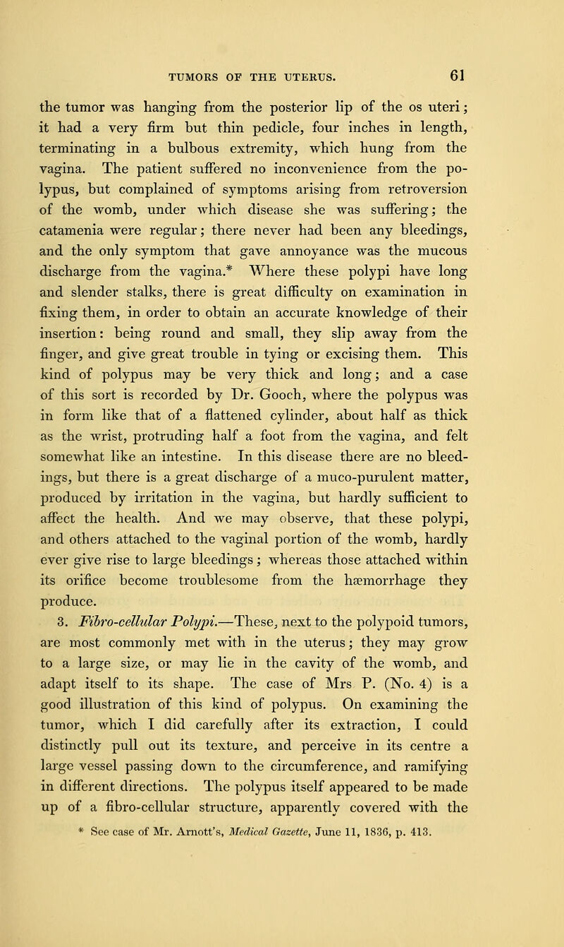 the tumor was hanging from the posterior lip of the os uteri; it had a very firm but thin pedicle, four inches in length, terminating in a bulbous extremity, which hung from the vagina. The patient suffered no inconvenience from the po- lypus, but complained of symptoms arising from retroversion of the womb, under which disease she was suffering; the catamenia were regular; there never had been any bleedings, and the only symptom that gave annoyance was the mucous discharge from the vagina.* Where these polypi have long and slender stalks, there is great difficulty on examination in fixing them, in order to obtain an accurate knowledge of their insertion: being round and small, they slip away from the finger, and give great trouble in tying or excising them. This kind of polypus may be very thick and long; and a case of this sort is recorded by Dr. Gooch, where the polypus was in form like that of a flattened cylinder, about half as thick as the wrist, protruding half a foot from the vagina, and felt somewhat like an intestine. In this disease there are no bleed- ings, but there is a great discharge of a muco-purulent matter, produced by irritation in the vagina, but hardly sufficient to affect the health. And we may observe, that these polypi, and others attached to the vaginal portion of the womb, hardly ever give rise to large bleedings; whereas those attached within its orifice become troublesome from the haemorrhage they produce. 3. Fibro-cellular Polypi.—These, next to the polypoid tumors, are most commonly met with in the uterus; they may grow to a large size, or may lie in the cavity of the womb, and adapt itself to its shape. The case of Mrs P. (No. 4) is a good illustration of this kind of polypus. On examining the tumor, which I did carefully after its extraction, I could distinctly pull out its texture, and perceive in its centre a large vessel passing down to the circumference, and ramifying in different directions. The polypus itself appeared to be made up of a fibro-cellular structure, apparently covered with the * See case of Mr. Arnott's, Medical Gazette, June 11, 1836, p. 413.