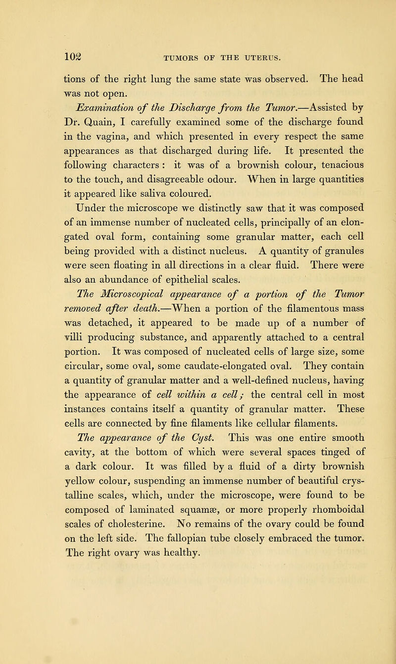 tions of the right lung the same state was observed. The head was not open. Examination of the Discharge from the Tumor.—Assisted by Dr. Quain, I carefully examined some of the discharge found in the vagina, and which presented in every respect the same appearances as that discharged during life. It presented the following characters : it was of a brownish colour, tenacious to the touch, and disagreeable odour. When in large quantities it appeared like saliva coloured. Under the microscope we distinctly saw that it was composed of an immense number of nucleated cells, principally of an elon- gated oval form, containing some granular matter, each cell being provided with a distinct nucleus. A quantity of granules were seen floating in all directions in a clear fluid. There were also an abundance of epithelial scales. The Microscopical appearance of a portion of the Tumor removed after death.—When a portion of the filamentous mass was detached, it appeared to be made up of a number of villi producing substance, and apparently attached to a central portion. It was composed of nucleated cells of large size, some circular, some oval, some caudate-elongated oval. They contain a quantity of granular matter and a well-defined nucleus, having the appearance of cell within a cell; the central cell in most instances contains itself a quantity of granular matter. These cells are connected by fine filaments like cellular filaments. The appearance of the Cyst. This was one entire smooth cavity, at the bottom of which were several spaces tinged of a dark colour. It was filled by a fluid of a dirty brownish yellow colour, suspending an immense number of beautiful crys- talline scales, which, under the microscope, were found to be composed of laminated squamae, or more properly rhomboidal scales of cholesterine. No remains of the ovary could be found on the left side. The fallopian tube closely embraced the tumor. The right ovary was healthy.