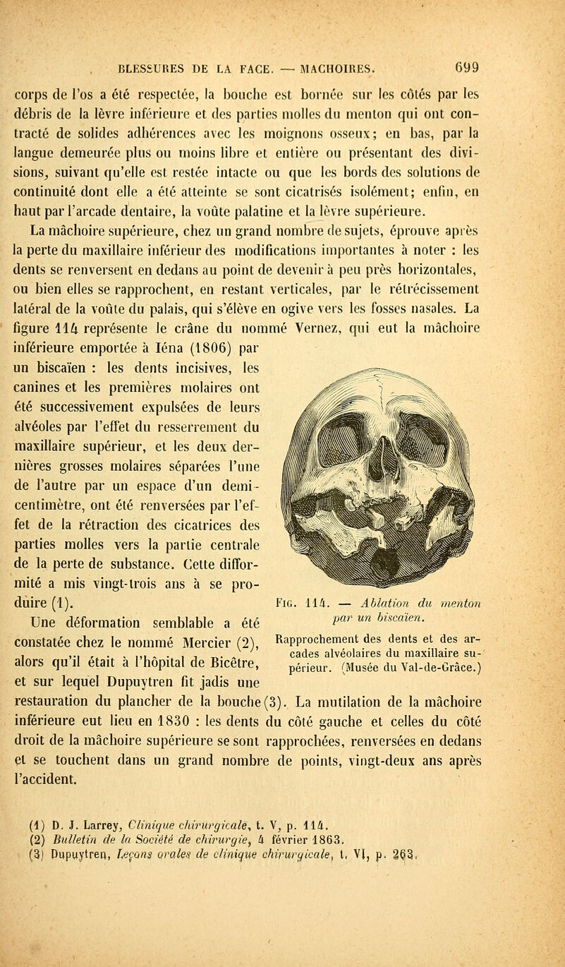 corps de l'os a été respectée, la bouche est bornée sur les côtés par les débris de la lèvre inférieure et des parties molles du menton qui ont con- tracté de solides adhérences avec les moignons osseux; en bas, par la langue demeurée plus ou moins libre et entière ou présentant des divi- sions, suivant qu'elle est restée intacte ou que les bords des solutions de continuité dont elle a été atteinte se sont cicatrisés isolément; enfin, en haut par l'arcade dentaire, la voûte palatine et la lèvre supérieure. La mâchoire supérieure, chez un grand nombre de sujets, éprouve après la perte du maxillaire inférieur des modifications importantes à noter : les dents se renversent en dedans au point de devenir à peu près horizontales, ou bien elles se rapprochent, en restant verticales, par le rétrécissement latéral de la voûte du palais, qui s'élève en ogive vers les fosses nasales. La figure 11& représente le crâne du nommé Veniez, qui eut la mâchoire inférieure emportée à Iéna (1806) par un biscaïen : les dents incisives, les canines et les premières molaires ont été successivement expulsées de leurs alvéoles par l'effet du resserrement du maxillaire supérieur, et les deux der- nières grosses molaires séparées l'une de l'autre par un espace d'un demi- centimètre, ont été renversées par l'ef- fet de la rétraction des cicatrices des parties molles vers la partie centrale de la perte de substance. Cette diffor- mité a mis vingt-trois ans à se pro- duire (1). Une déformation semblable a été constatée chez le nommé Mercier (2), alors qu'il était à l'hôpital de Bicêtre, et sur lequel Dupuytren fit jadis une restauration du plancher de la bouche (3). La mutilation de la mâchoire inférieure eut lieu en 1830 : les dents du côté gauche et celles du côté droit de la mâchoire supérieure se sont rapprochées, renversées en dedans et se touchent dans un grand nombre de points, vingt-deux ans après l'accident. Fig. 114. — Ablation du menton par un biscaïen. Rapprochement des dents et des ar- cades alvéolaires du maxillaire su- périeur. (Musée du Val-de-Grâce.) (1) D. J. Larrey, Clinique chirurgicale, t. V, p. 114. (2) Bulletin de la Société de chirurgie, à février 1863. (3) Pupuytren, Leçons orales de clinique chirurgicale, t. V}, p. m