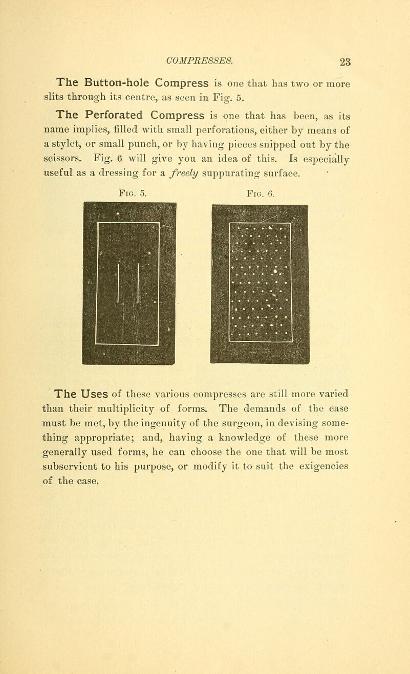 The Button-hole Compress is one that has two or more slits through its centre, as seen in Fig. 5. The Perforated Compress is one that has been, as its name implies, filled with small perforations, either by means of a stylet, or small punch, or by having pieces snipped out by the scissors. Fig. 6 will give you an idea of this. Is esjDecially useful as a dressing for a freely suppurating surface. Fig. 6. Fig. 5. The Uses of these various compresses are still more varied than their multiplicity of forms. The demands of the case must be met, by the ingenuity of the surgeon, in devising some- thing appropriate; and, having a knowledge of these more generally used forms, he can choose the one that will be most subservient to his purpose, or modify it to suit the exigencies of the case.