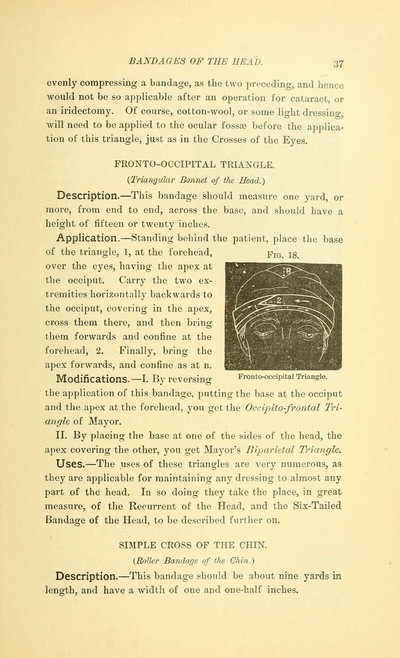 evenly compressing a bandage, as the two preceding, and hence would not be so applicable after an operation for cataract, or an iridectomy. Of course, cotton-wool, or some light dressing, will need to be applied to the ocular fossae before the applica- tion of this triangle, just as in the Crosses of the Eyes. FRONTO-OCCIPITAL TRIANGLE. (Triangular Bonnet of tlie Head.) Description.—This bandage should measure one yard, or more, from end to end, across the base, and should have a height of fifteen or twenty inches. Application.—Standing behind the patient, place the base of the triangle, 1, at the forehead, -pm. 18. over the eyes, having the apex at the occiput. Carry the two ex- tremities horizontally backwards to the occiput, covering in the apex, cross them there, and then bring them forwards and confine at the forehead, 2. Finally, bring the apex forwards, and confine as at b„ Modifications.—L By reversing Fronto-occipital Triangle, the application of this bandage, putting the base at the occiput and the apex at the forehead, you get the Occipito-frontal Tri- angle of Mayor. II. By placing the base at one of the sides of the head, the apex covering the other, you get Mayor's Biparietal Triangle. Uses.—The uses of these triangles are very numerous, as they are applicable for maintaining any dressing to almost any part of the head. In so doing they take the place, in great measure, of the Recurrent of the Head, and the Six-Tailed Bandage of the Head, to be described further on. SIMPLE CROSS OF THE CHIN. {Roller Bandage of the Chin.) Description.—This bandage should be about nine yards in length, and have a width of one and one-half inches.