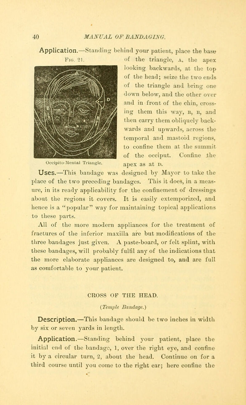 Application.—Standing behind your patient, place the base Fig. 21. of the triangle, a, the apex looking backwards, at the top of the head; seize the two ends of the triangle and bring one down below, and the other over and in front of the chin, cross- ing them this way, b, b, and then carry them obliquely back- wards and upwards, across the temporal and mastoid regions, to confine them at the summit of the occiput. Confine Jthe Occipitomental Triangle. anex as at D. Uses.—This bandage was designed by Mayor to take the place of the two preceding bandages. This it does, in a meas- ure, in its ready applicability for the confinement of dressings about the regions it covers. It is easily extemporized, and hence is a popular way for maintaining topical applications to these parts. All of the more modern appliances for the treatment of fractures of the inferior maxilla are but modifications of the three bandages just given. A paste-board, or felt splint, with these bandages, will probably fulfil any of the indications that the more elaborate appliances are designed to, and are full as comfortable to your patient. CROSS OF THE HEAD. {Temple Bandage.) Description.—This bandage should be two inches in width by six or seven yards in length. Application.—Standing behind your patient, place the initial end of the bandage, 1, over the right eye, and confine it by a circular turn, 2, about the head. Continue on for a third course until you come to the right ear; here confine the