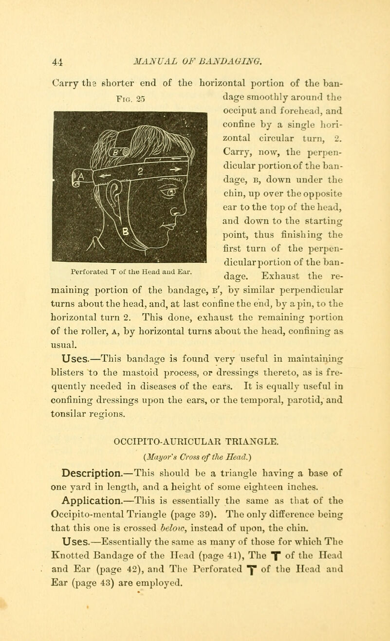 Carry the shorter end of the horizontal portion of the ban- Y\g. 25 dage smoothly around the occiput and forehead, and confine by a single hori- zontal circular turn, 2. Carry, now, the perpen- dicular portion of the ban- dage, b, down under the chin, up over the opposite ear to the top of the head, and down to the starting point, thus finishing the first turn of the perpen- dicular portion of the ban- dage. Exhaust the re- maining portion of the bandage, b', by similar perpendicular turns about the head, and, at last confine the end, by a pin, to the horizontal turn 2. This done, exhaust the remaining portion of the roller, a, by horizontal turns about the head, confining as usual. Uses.—This bandage is found very useful in maintaining blisters to the mastoid process, or dressings thereto, as is fre- quently needed in diseases of the ears. It is equally useful in confining dressings upon the ears, or the temporal, parotid, and tonsilar recrions. Perforated T of the Head and Ear. OCCIPITO-AURICULAR TRIANGLE. {Mayor's Cross of the Head.) Description.—This should be a triangle having a base of one yard in length, and a height of some eighteen inches. Application.—This is essentially the same as that of the Occipito-mental Triangle (page 39). The only difference being that this one is crossed below, instead of upon, the chin. Uses.—Essentially the same as many of those for which The Knotted Bandage of the Head (page 41), The T °f tue Head and Ear (page 42), and The Perforated y of the Head and Ear (page 43) are employed.