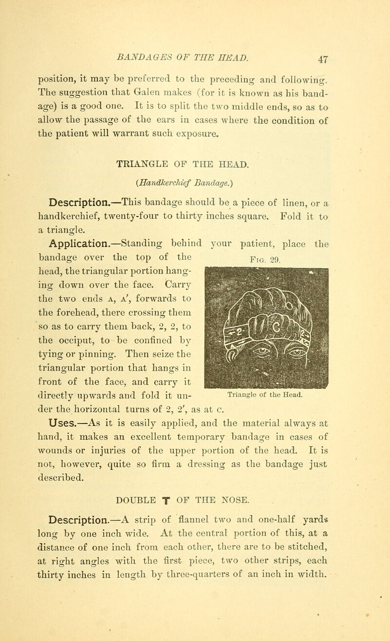 position, it may be preferred to the preceding and following. The suggestion that Galen makes (for it is known as his band- age) is a good one. It is to split the two middle ends, so as to allow the passage of the ears in cases where the condition of the patient will warrant such exposure. your patient, place Fig. 29. the TRIANGLE OF THE HEAD. {Handkerchief Bandage.) Description.—This bandage should be a piece of linen, or a handkerchief, twenty-four to thirty inches square. Fold it to a triangle. Application.—Standing behind bandage over the top of the head, the triangular portion hang- ing down over the face. Carry the two ends a, a', forwards to the forehead, there crossing them so as to carry them back, 2, 2, to the occiput, to be confined by tying or jnnning. Then seize the triangular portion that hangs in front of the face, and carry it directly upwards and fold it un- der the horizontal turns of 2, 2', as at c. Uses.—As it is easily applied, and the material always at hand, it makes an excellent temporary bandage in cases of wounds or injuries of the upper portion of the head. It is not, however, quite so firm a dressing as the bandage just described. Triangle of the Head. DOUBLE T OF THE NOSE. Description.—A strip of flannel two and one-half yards long by one inch wide. At the central portion of this, at a distance of one inch from each other, there are to be stitched, at right angles with the first piece, two other strips, each thirty inches in length by three-quarters of an inch in width.