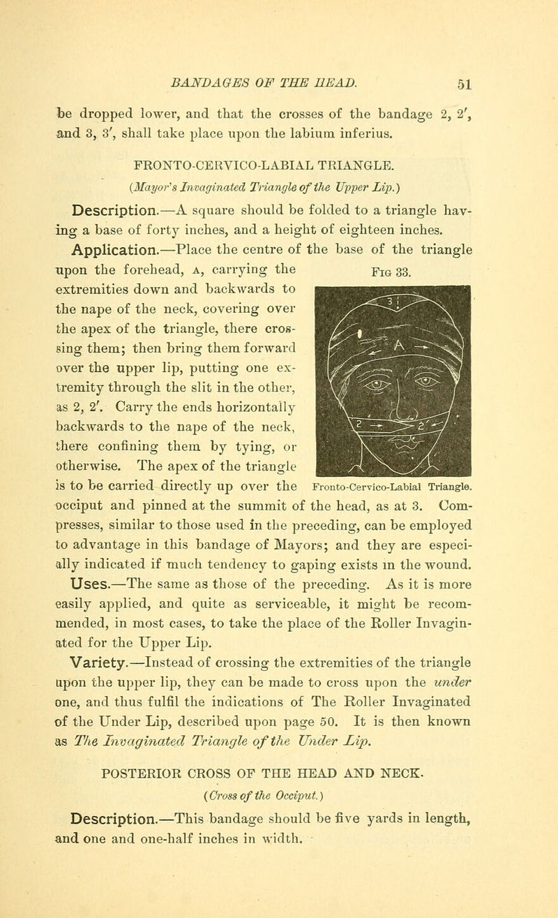 be dropped lower, and that the crosses of the bandage 2, 2', and 3, 3', shall take place upon the labium, inferius. FRONTO-CERVICO-LABIAL TRIANGLE. {Mayor's Invaginated Triangle of the Upper Lip.) Description.—A square should be folded to a triangle hav- ing a base of forty inches, and a height of eighteen inches. Application.—Place the centre of the base of the triangle upon the forehead, a, carrying the fig 33, extremities down and backwards to the nape of the neck, covering over the apex of the triangle, there cros- sing them; then bring them forward over the upper lip, putting one ex- tremity through the slit in the other, as 2, 2\ Carry the ends horizontally backwards to the nape of the neck, there confining them by tying, or otherwise. The apex of the triangle is to be carried directly Up over the Fronto-Cervico-Labial Triangle. occiput and pinned at the summit of the head, as at 3. Com- presses, similar to those used in the preceding, can be employed to advantage in this bandage of Mayors; and they are especi- ally indicated if much tendency to gaping exists in the wound. Uses.—The same as those of the preceding. As it is more easily applied, and quite as serviceable, it might be recom- mended, in most cases, to take the place of the Roller Invagin- ated for the Upper Lip. Variety.—Instead of crossing the extremities of the triangle upon the upper lip, they can be made to cross upon the under one, and thus fulfil the indications of The Roller Invaginated of the Under Lip, described upon page 50. It is then known as The Invaginated Triangle of the Under Lip. POSTERIOR CROSS OF THE HEAD AND NECK. {Cross of the Occiput.) Description.—This bandage should be five yards in length, and one and one-half inches in width.
