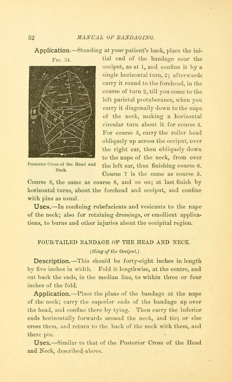 Application.—Standing at your patient's back, place the ini- FIG. 34. tial end of the bandage near the occiput, as at 1, and confine it by a single horizontal turn, 2; afterwards carry it round to the forehead, in the course of turn 2, till you come to the left parietal protuberance, when you carry it diagonally down to the nape of the neck, making a horizontal circular turn about it for course 4. For course 5, carry the roller head obliquely up across the occiput, over the right ear, then obliquely down to the nape of the neck, from over the left ear, thus finishing course 6. Course 7 is the same as course 5. Course 8, the same as course 6, and so on; at last finish by horizontal turns, about the forehead and occiput, and confine with pins as usual, . Uses.—In confining rubefacients and vesicants to the nape of the neck; also for retaining dressings, or emollient applica- tions, to burns and other injuries about the occipital region. Posterior Cross of the Head and Neck. FOUR-TAILED BANDAGE OP THE HEAD AND NECK. (Sling of the Occiput.) Description.—This should be forty-eight inches in length by five inches in width. Fold it lengthwise, at the centre, and cut back the ends, in the median line, to within three or four inches of the fold. Application.—Place the plane of the bandage at the nape of the neck; carry the superior ends of the bandage up over the head, and confine there by tying. Then carry the inferior ends horizontally forwards around the neck, and tie; or else cross them, and return to the back of the neck with them, and there pin. Uses.—Similar to that of the Posterior Cross of the Head and Neck, described above.