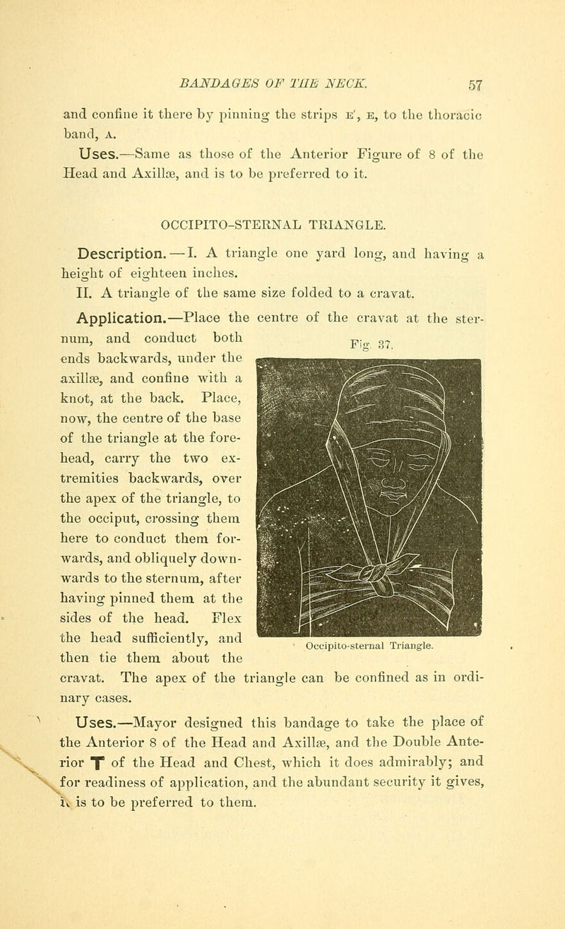 and confine it there by pinning the strips is', e, to the thoracic band, A. Uses.—Same as those of the Anterior Figure of 8 of the Head and Axilloe, and is to be preferred to it. OCCIPITO-STERNAL TRIANGLE. Description.—I. A triangle one yard long, and having a height of eighteen inches. II. A triangle of the same size folded to a cravat. Application.—Place the centre of the cravat at the ster- num, and conduct both ends backwards, under the axillae, and confine with a knot, at the back. Place, now, the centre of the base of the triangle at the fore- head, carry the two ex- tremities backwards, over the apex of the triangle, to the occiput, crossing them here to conduct them for- wards, and obliquely down- wards to the sternum, after having pinned them at the sides of the head. Flex the head sufficiently, and then tie them about the cravat. The apex of the triangle can be confined as in ordi- nary cases. Uses.—Mayor designed this bandage to take the place of the Anterior 8 of the Head and Axillae, and the Double Ante- rior X °f tue Head and Chest, which it does admirably; and for readiness of application, and the abundant security it gives, u is to be preferred to them. Occipito-sternal Triangle.