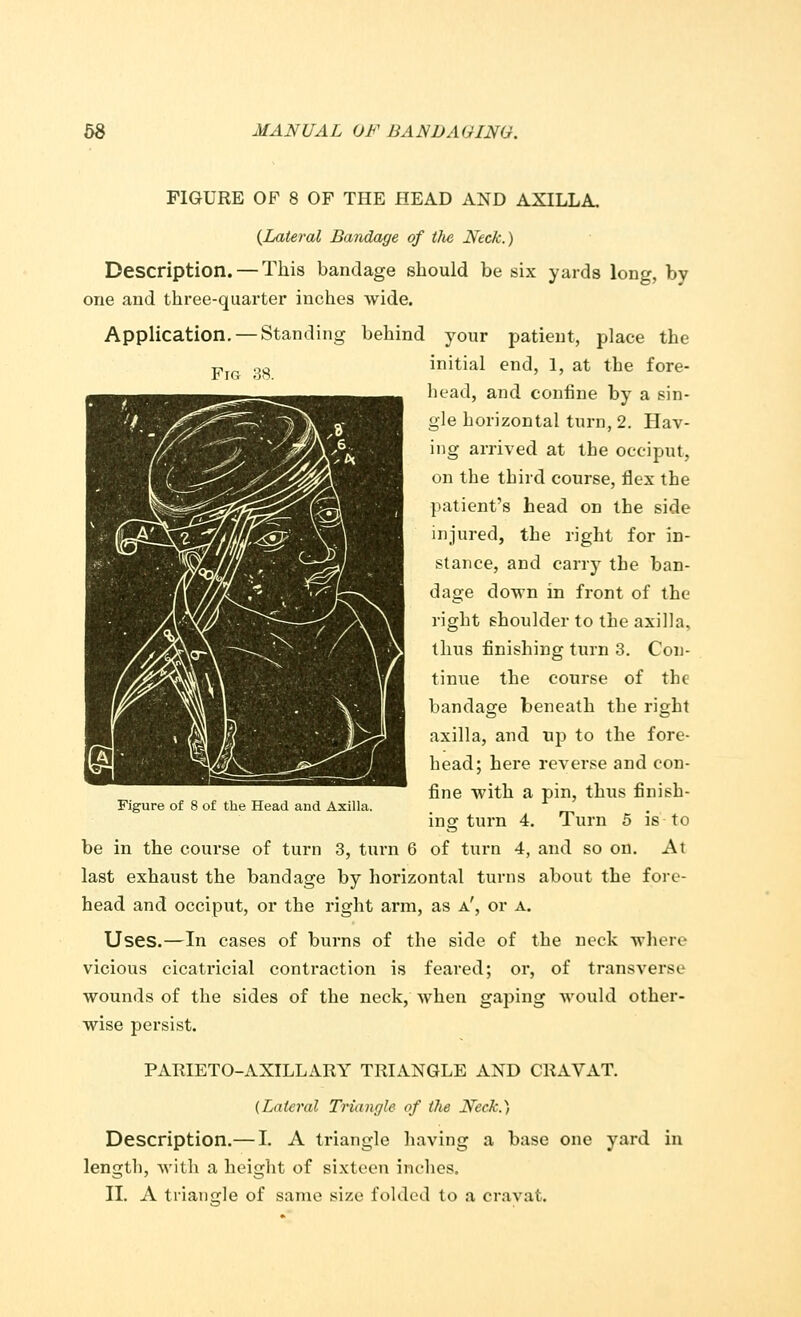Fig 38. FIGURE OF 8 OF THE HEAD AND AXILLA. {Lateral Bandage of tfie Neck.) Description. — This bandage should be six yards long, by one and three-quarter inches wide. Application. — Standing behind your patient, place the initial end, 1, at the fore- head, and confine by a sin- gle horizontal turn, 2. Hav- ing arrived at the occiput, on the third course, flex the patient's head on the side injured, the right for in- stance, and carry the ban- dage down in front of the right shoulder to the axilla, thus finishing turn 3. Con- tinue the course of the bandage beneath the right axilla, and up to the fore- head; here reverse and con- fine with a pin, thus finish- ing turn 4. Turn 5 is to be in the course of turn 3, turn 6 of turn 4, and so on. At last exhaust the bandage by horizontal turns about the fore- head and occiput, or the right arm, as a', or a. Uses.—In cases of burns of the side of the neck where vicious cicatricial contraction is feared; or, of transverse wounds of the sides of the neck, when gaping would other- wise persist. PARIETO-AXILLARY TRIANGLE AND CRAVAT. (Lateral Triangle of the Neck.) Description.— I. A triangle having a base one yard in length, with a height of sixteen inches. Figure of 8 of the Head and Axilla.