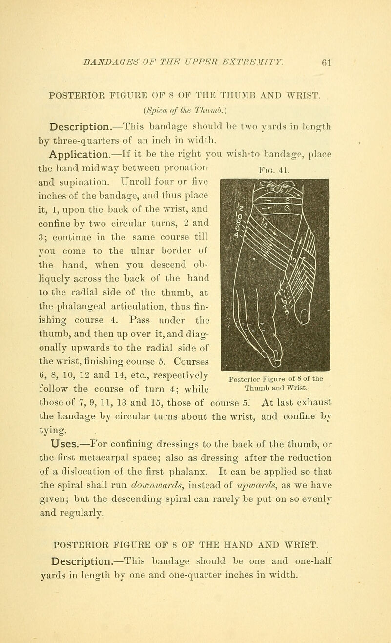 POSTERIOR FIGURE OF 8 OF THE THUMB AND WRIST. (Spica of the Thumb.) Description.—This bandage should be two yards in length by three-quarters of an inch in width. Application.—If it be the right you wish-to bandage, place the hand midway between pronation prG 41 and supination. Unroll four or five inches of the bandage, and thus place it, 1, upon the back of the wrist, and confine by two circular turns, 2 and 3; continue in the same course till you come to the ulnar border of the hand, when you descend ob- liquely across the back of the hand to the radial side of the thumb, at the phalangeal articulation, thus fin- ishing course 4. Pass under the thumb, and then up over it, and diag- onally upwards to the radial side of the wrist, finishing course 5. Courses 6, 8, 10, 12 and 14, etc., respectively follow the course of turn 4; while those of 7,9, 11, 13 and 15, those of course 5. At last exhaust the bandage by circular turns about the wrist, and confine by tying. Uses.—For confining dressings to the back of the thumb, or the first metacarpal space; also as dressing after the reduction of a dislocation of the first phalanx. It can be applied so that the spiral shall run dowmcards, instead of upwards, as we have given; but the descending spiral can rarely be put on so evenly and regularly. Posterior Figure of 8 of the Thumb and Wrist. POSTERIOR FIGURE OF 8 OF THE HAND AND WRIST. Description.—This bandage should be one and one-half yards in length by one and one-quarter inches in width.