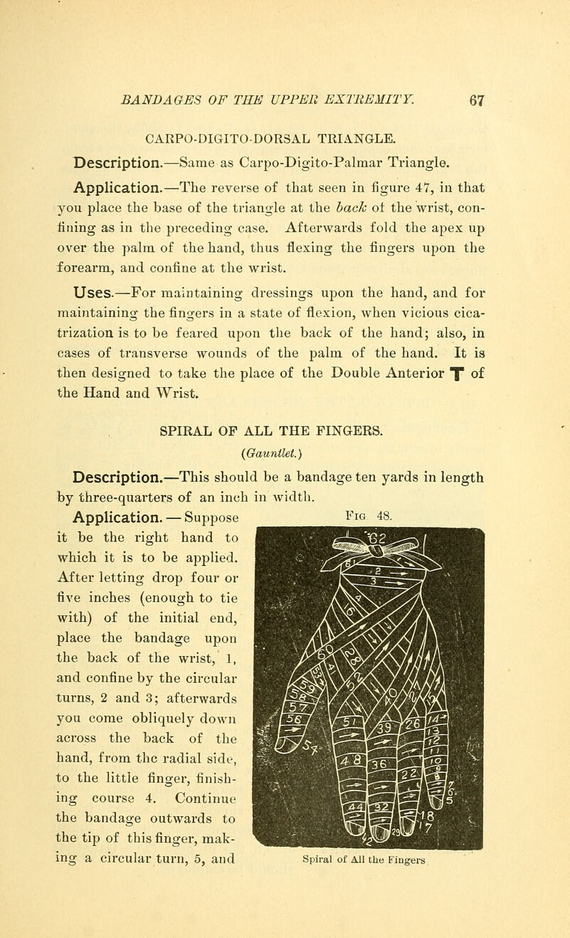 CARPO-DIGITO-DORSAL TRIANGLE. Description.—Same as Carpo-Digito-Palmar Triangle. Application.—The reverse of that seen in figure 47, in that you place the base of the triangle at the back of the wrist, con- fining as in the preceding case. Afterwards fold the apex up over the palm of the hand, thus flexing the fingers upon the forearm, and confine at the wrist. Uses.—For maintaining dressings upon the hand, and for maintaining the fingers in a state of flexion, when vicious cica- trization is to be feared upon the back of the hand; also, in cases of transverse wounds of the palm of the hand. It is then designed to take the place of the Double Anterior X °f the Hand and Wrist. SPIRAL OF ALL THE FINGERS. (Gauntlet.) Description.—This should be a bandage ten yards in length by three-quarters of an inch in width. Application. — Suppose it be the right hand to which it is to be applied. After letting drop four or five inches (enough to tie with) of the initial end, place the bandage upon the back of the wrist, 1, and confine by the circular turns, 2 and 3; afterwards you come obliquely down across the back of the hand, from the radial side, to the little finger, finish- ing course 4. Continue the bandage outwards to the tip of this finger, mak- ing a circular turn, 5, and Spiral of All the Fingers