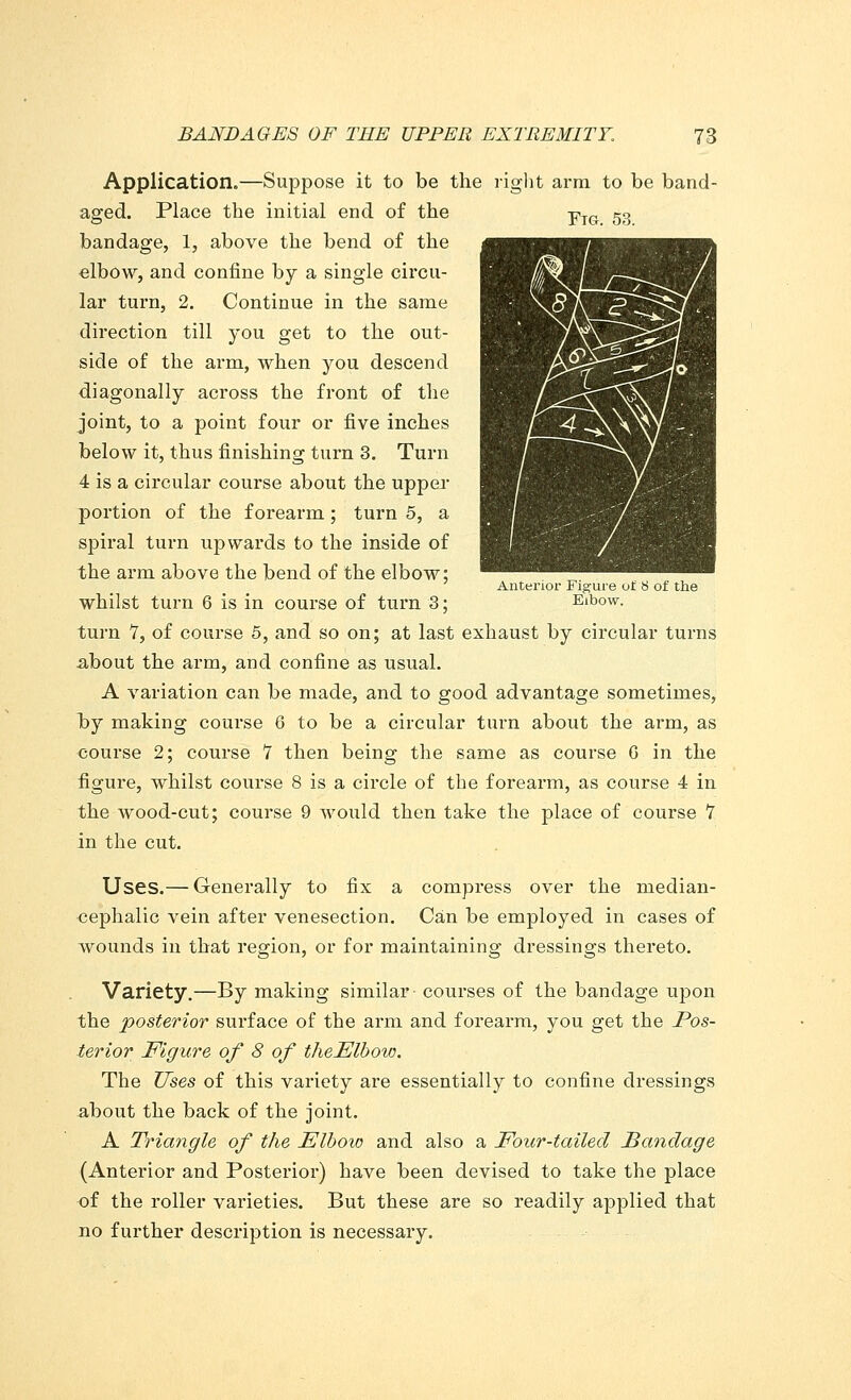 Application.—Suppose it to be the right arm to be band- aged. Place the initial end of the yIG 5g bandage, 1, above the bend of the elbow, and confine by a single circu- lar turn, 2. Continue in the same direction till you get to the out- side of the arm, when you descend diagonally across the front of the joint, to a point four or five inches below it, thus finishing turn 3. Turn 4 is a circular course about the upper portion of the forearm; turn 5, a spiral turn upwards to the inside of the arm above the bend of the elbow; whilst turn 6 is in course of turn 3; turn 7, of course 5, and so on; at last exhaust by circular turns about the arm, and confine as usual. A variation can be made, and to good advantage sometimes, Tby making course 6 to be a circular turn about the arm, as course 2; course 7 then being the same as course G in the figure, whilst course 8 is a circle of the forearm, as course 4 in the wood-cut; course 9 would then take the place of course 7 in the cut. Anterior Figure oi! 8 of the Elbow. Uses.— Generally to fix a compress over the median- cephalic vein after venesection. Can be employed in cases of wounds in that region, or for maintaining dressings thereto. Variety.—By making similar courses of the bandage upon the posterior surface of the arm and forearm, you get the Pos- terior Figure of 8 of theElbow. The Uses of this variety are essentially to confine dressings about the back of the joint. A Triangle of the Elbow and also a Four-tailed Bandage (Anterior and Posterior) have been devised to take the place of the roller varieties. But these are so readily applied that no further description is necessary.