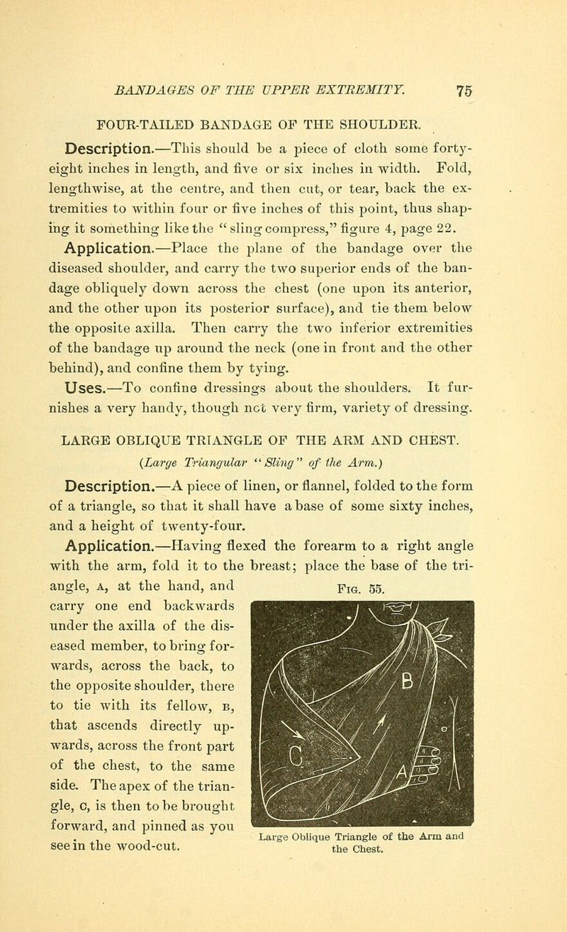 FOUR-TAILED BANDAGE OF THE SHOULDER. Description.—This should be a piece of cloth some forty- eight inches in length, and five or six inches in width. Fold, lengthwise, at the centre, and then cut, or tear, back the ex- tremities to within four or five inches of this point, thus shap- ing it something like the sling compress, figure 4, page 22. Application.—Place the plane of the bandage over the diseased shoulder, and carry the two superior ends of the ban- dage obliquely down across the chest (one upon its anterior, and the other upon its posterior surface), and tie them below the opposite axilla. Then carry the two inferior extremities of the bandage up around the neck (one in front and the other behind), and confine them by tying. Uses.—To confine dressings about the shoulders. It fur- nishes a very handy, though net very firm, variety of dressing. LARGE OBLIQUE TRIANGLE OF THE ARM AND CHEST. {Large Triangular Sling of the Arm.) Description.—A piece of linen, or flannel, folded to the form of a triangle, so that it shall have a base of some sixty inches, and a height of twenty-four. Application.—Having flexed the forearm to a right angle with the arm, fold it to the breast; place the base of the tri- angle, a, at the hand, and FIG 55^ carry one end backwards under the axilla of the dis- eased member, to bring for- wards, across the back, to the opposite shoulder, there to tie with its fellow, b, that ascends directly up- wards, across the front part of the chest, to the same side. The apex of the trian- gle, c, is then to be brought forward, and pinned as you Large Oblique Triangle of the Arm and see in the wood-cut. the Chest.