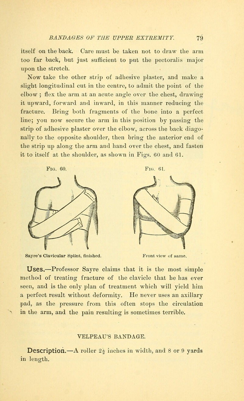 itself on the back. Care must be taken not to draw the arm too far back, but just sufficient to put the pectoralis major upon the stretch. Now take the other strip of adhesive plaster, and make a slight longitudinal cut in the centre, to admit the point of the elbow ; flex the arm at an acute angle over the chest, drawing it upward, forward and inward, in this manner reducing the fracture. Bring both fragments of the bone into a perfect line; you now secure the arm in this position by passing the strip of adhesive plaster over the elbow, across the back diago- nally to the opposite shoulder, then bring the anterior end of the strip up along the arm and hand over the chest, and fasten it to itself at the shoulder, as shown in Figs. 60 and 61. Fig. 60. Fig. 61. Sayre's Clavicular Splint, finished. Front view of same. Uses.—Professor Sayre claims that it is the most simple method of treating fracture of the clavicle that he has ever seen, and is the only plan of treatment which will yield him a perfect result without deformity. He never uses an axillary pad, as the pressure from this often stops the circulation in the arm, and the pain resulting is sometimes terrible. VELPEAU'S BANDAGE. Description.—A roller 2f inches in width, and 8 or 9 yards in length.