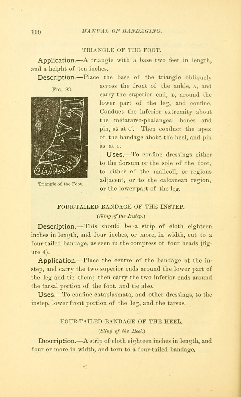 Fig. 83. TRIANGLE OF THE FOOT. Application.—A triangle with a base two feet in length, and a height of ten inches. Description.—Place the base of the triangle obliquely across the front of the ankle, a, and carry the superior end, b, around the lower part of the leg, and confine. Conduct the inferior extremity about the metatarso-phalangeal bones and pin, as at c\ Then conduct the apex of the bandage about the heel, and pin as at c. Uses.—To confine dressings either to the dorsum or the sole of the foot, to either of the malleoli, or regions adjacent, or to the calcanean region.,, or the lower part of the leg. Triangle of the Foot. FOUR-TAILED BANDAGE OF THE INSTEP. (Sling of the Instep.) Description. — This should be -a strip of cloth eighteen inches in length, and four inches, or moie, in width, cut to a four-tailed bandage, as seen in the compress of four heads (fig- ure 4). Application.—Place the centre of the bandage at the in- step, and carry the two superior ends around the lower part of the leg and tie them; then carry the two inferior ends around the tarsal portion of the foot, and tie also. Uses.—To confine cataplasmata, and other dressings, to the instep, lower front portion of the leg, and the tarsus. FOUR-TAILED BANDAGE OF THE HEEL. (Sling of the Heel.') Description.—A strip of cloth eighteen inches in length, and four or more in width, and torn to a four-tailed bandage.