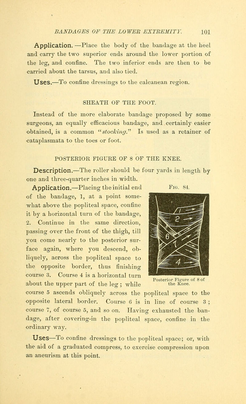 Application. —Place the body of the bandage at the heel and carry the two superior ends around the lower portion of the leg, and confine. The two inferior ends are then to be carried about the tarsus, and also tied. Uses.—To confine dressings to the calcanean region. SHEATH OF THE FOOT. Instead of the more elaborate bandage proposed by some surgeons, an equally efficacious bandage, and certainly easier obtained, is a common stocking. Is used as a retainer of cataplasmata to the toes or foot. Fig. 84. POSTEEIOR FIGURE OF 8 OF THE KNEE. Description.—The roller should be four yards in length by one and thi-ee-quarter inches in width. Application.—Placing the initial end of the bandage, 1, at a point some- what above the popliteal space, confine it by a horizontal turn of the bandage, 2. Continue in the same direction, passing over the front of the thigh, till you come nearly to the posterior sur- face again, where you descend, ob- liquely, across the popliteal space to the opposite border, thus finishing course 3. Course 4 is a horizontal turn about the upper part of the leg ; while course 5 ascends obliquely across the popliteal space to the opposite lateral border. Course 6 is in line of course 3 ; course V, of course 5, and so on. Having exhausted the ban- dage, after covering-in the popliteal space, confine in the ordinaiy way. Uses—To confine dressings to the popliteal space; or, with the aid of a graduated compress, to exercise compression upon an aneurism at this point. Posterior Figure of 8 of the Knee.