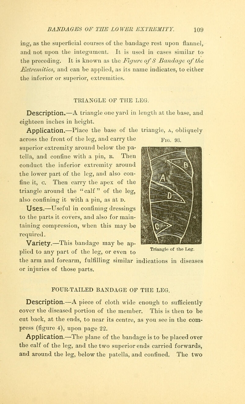 ing, as the superficial courses of the bandage rest upon flannel, and not upon the integument. It is used in cases similar to the preceding. It is known as the Figure of 8 Bandage of the Extremities, and can be applied, as its name indicates, to either the inferior or superior, extremities. TRIANGLE OF THE LEG. Description.—A triangle one yard in length at the base, and eighteen inches in height. Application.—Place the base of the triangle, a, obliquely across the front of the leg, and carry the pIGi 93, superior extremity around below the pa- tella, and confine with a pin, b. Then conduct the inferior extremity around the lower part of the leg, and also con- fine it, c. Then carry the apex of the triangle around the  calf  of the leg, also confining it with a pin, as at d. Uses.—Useful in confining dressings to the parts it covers, and also for main- taining compression, when this may be required. Variety.—This bandage may be ap- plied to any part of the leg, or even to TriaDgle °f the Leg> the arm and forearm, fulfilling similar indications in diseases or injuries of those parts. FOUR-TAILED BANDAGE OF THE LEG. Description.—A piece of cloth wide enough to sufficiently cover the diseased portion of the member. This is then to be cut back, at the ends, to near its centre, as you see in the com- press (figure 4), upon page 22. Application.—The plane of the bandage is to be placed over the calf of the leg, and the two superior ends carried forwards, and around the leg, below the patella, and confined. The two