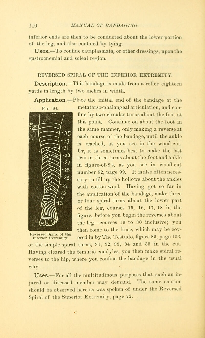 inferior ends are then to be condueted about the lower portion of the leg, and also confined by tying. Uses.—To confine cataplasmata, or other dressings, upon the gastrocnemial and soleal region. REVERSED SPIRAL OF THE INFERIOR EXTREMITY. Description.—This bandage is made from a roller eighteen yards in length by two inches in width. Application.—Place the initial end of the bandage at the FrG. 94. metatarsophalangeal articulation, and con- fine by two circular turns about the foot at this point. Continue on about the foot in the same manner, only making a reverse at each course of the bandage, until the ankle is reached, as you see in the wood-cut. Or, it is sometimes best to make the last two or three turns about the foot and ankle in figure-of-8's, as you see in wood-cut number 82, page 99. It is also often neces- sary to fill up the hollows about the ankles with cotton-wool. Having got so far in the application of the bandage, make three or four spiral turns about the lower part of the leg, courses 15, 16, 17, 18 in. the figure, before you begin the reverses about the leg—courses 19 to 30 inclusive; you then come to the knee, which may be cov- Reversed Spiral of the , . . rni m -, n or. , „„ iufeiior Extremity. ered in by The Testudo, figure S9, page 103, or the simple spiral turns, 31, 32, 33, 34 and 35 in the cut. Having cleared the femuric condyles, you then make spiral re- verses to the hip, where you confine the bandage in the usual way. Uses.—For all the multitudinous purposes that such an in- jured or diseased member may demand. The same caution should be observed here as was spoken of under the Reversed Spiral of the Superior Extremity, page 72.