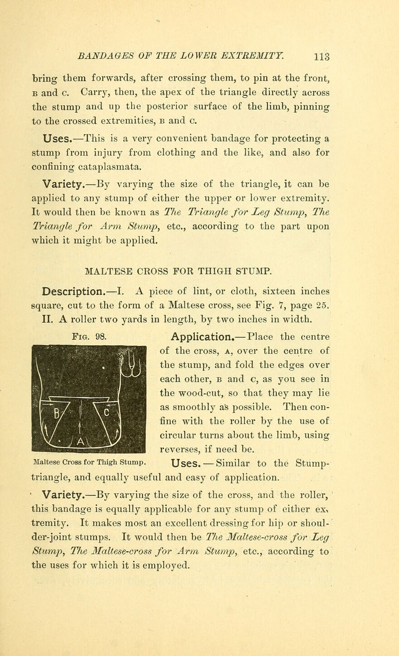 bring them forwards, after crossing them, to pin at the front, b and c. Carry, then, the apex of the triangle directly across the stump and up the posterior surface of the limb, pinning to the crossed extremities, b and c. Uses.—This is a very convenient bandage for protecting a stump from injury from clothing and the like, and also for confining cataplasmata. Variety.—By varying the size of the triangle, it can be applied to any stump of either the upper or lower extremity. It would then be known as The Triangle for Leg Stump, The Triangle for Arm Stump, etc., according to the part upon which it might be applied. MALTESE CROSS FOR THIGH STUMP. Description.—I. A piece of lint, or cloth, sixteen inches square, cut to the form of a Maltese cross, see Fig. 1, page 25. II. A roller two yards in length, by two inches in width. Fig. 98. Application.—Place the centre of the cross, a, over the centre of the stump, and fold the edges over each other, b and c, as you see in the wood-cut, so that they may lie as smoothly as possible. Then con- fine with the roller by the use of circular turns about the limb, using reverses, if need be. Maltese Cross for Thigh Stump. Uses. — Similar to the Stump- triangle, and equally useful and easy of application. • Variety.—By varying the size of the cross, and the roller, this bandage is equally applicable for any stump of either ex^ tremity. It makes most an excellent dressing for hip or shoul- der-joint stumps. It would then be The Maltese-cross for Leg Stump, The Maltese-cross for Arm Stump, etc., according to the uses for which it is employed.