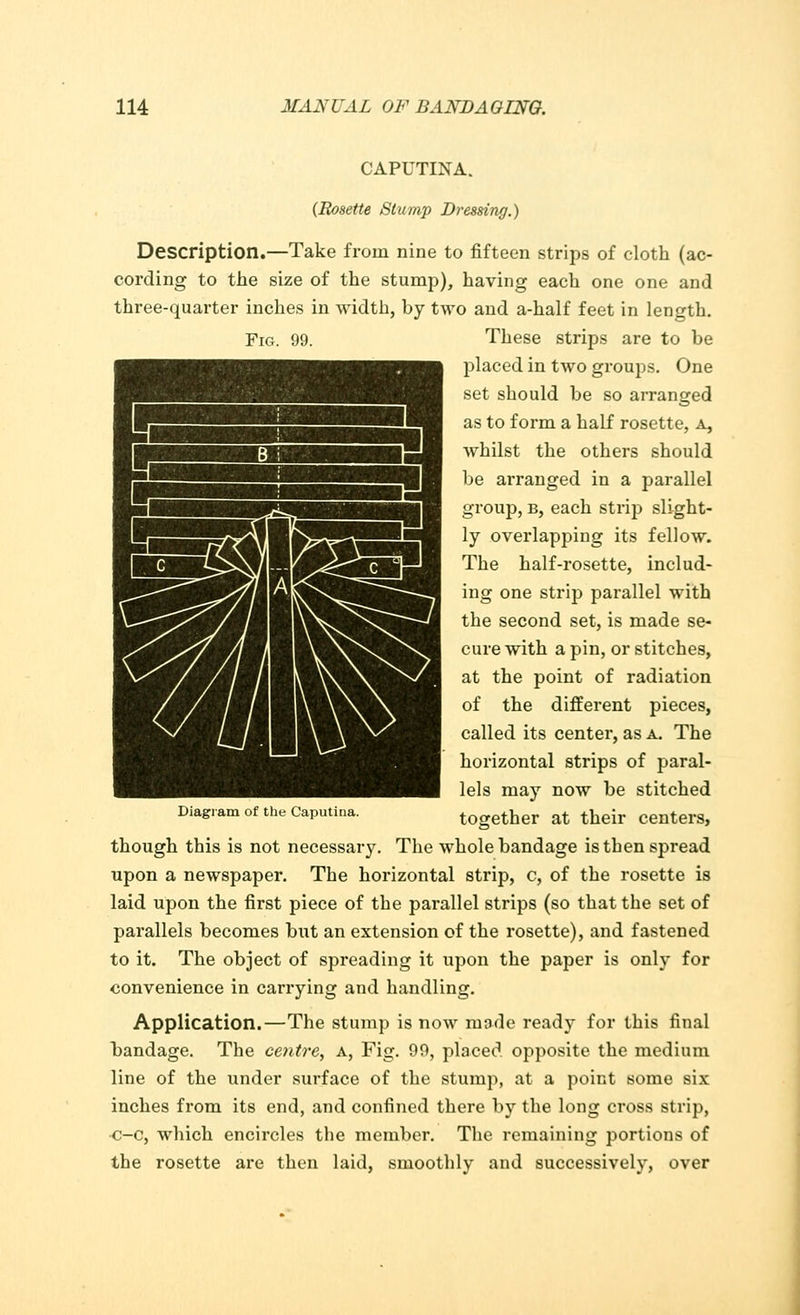 CAPUTINA. (Rosette Slump Dressing.) Description.—Take from nine to fifteen strips of cloth (ac- cording to the size of the stump), having each one one and three-quarter inches in width, by two and a-half feet in length. Fig. 99. These strips are to be placed in two groups. One set should be so arranged as to form a half rosette, a, whilst the others should be arranged in a parallel group, b, each strip slight- ly overlapping its fellow. The half-rosette, includ- ing one strip parallel with the second set, is made se- cure with a pin, or stitches, at the point of radiation of the different pieces, called its center, as a. The horizontal strips of paral- lels may now be stitched Diagram of the caputina. together at their centers, though this is not necessary. The whole bandage is then spread upon a newspaper. The horizontal strip, c, of the rosette is laid upon the first piece of the parallel strips (so that the set of parallels becomes but an extension of the rosette), and fastened to it. The object of spreading it upon the paper is only for convenience in carrying and handling. Application.—The stump is now mode ready for this final bandage. The centre, a, Fig. 99, placed opposite the medium line of the under surface of the stump, at a point some six inches from its end, and confined there by the long cross strip, c-c, which encircles the member. The remaining portions of the rosette are then laid, smoothly and successively, over