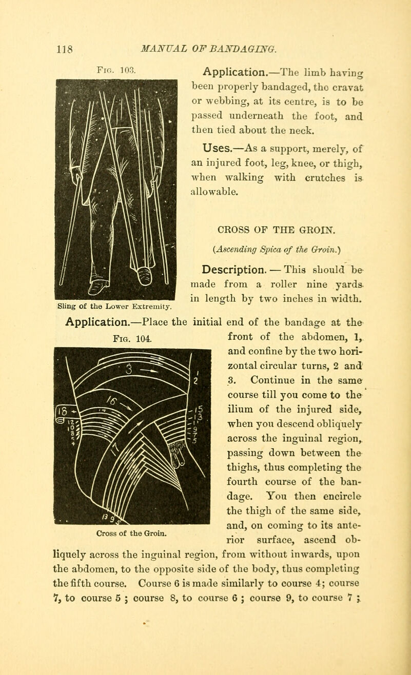 Fig. 103. Application.—The limb having been properly bandaged, the cravat or webbing, at its centre, is to be passed underneath the foot, and then tied about the neck. Uses.—As a support, merely, of an injured foot, leg, knee, or thigh, when walking with crutches is allowable. CROSS OF THE GROIN. (Ascending Spica of the Groin.) Description. — This should be- made from a roller nine yards- in length by two inches in width. Sling of the Lower Extremity. Application.—Place the initial end of the bandage at the Fig. 104. front of the abdomen, 1, and confine by the two hori- zontal circular turns, 2 and 3. Continue in the same course till you come to the ilium of the injured side, when you descend obliquely across the inguinal region, passing down between the thighs, thus completing the fourth course of the ban- dage. You then encircle the thigh of the same side, and, on coming to its ante- rior surface, ascend ob- liquely across the inguinal region, from without inwards, upon the abdomen, to the opposite side of the body, thus completing the fifth course. Course 6 is made similarly to course 4; course 1} to course 5 ; course 8, to course 6 ; course 9, to course 7 'y Cross of the Groin.