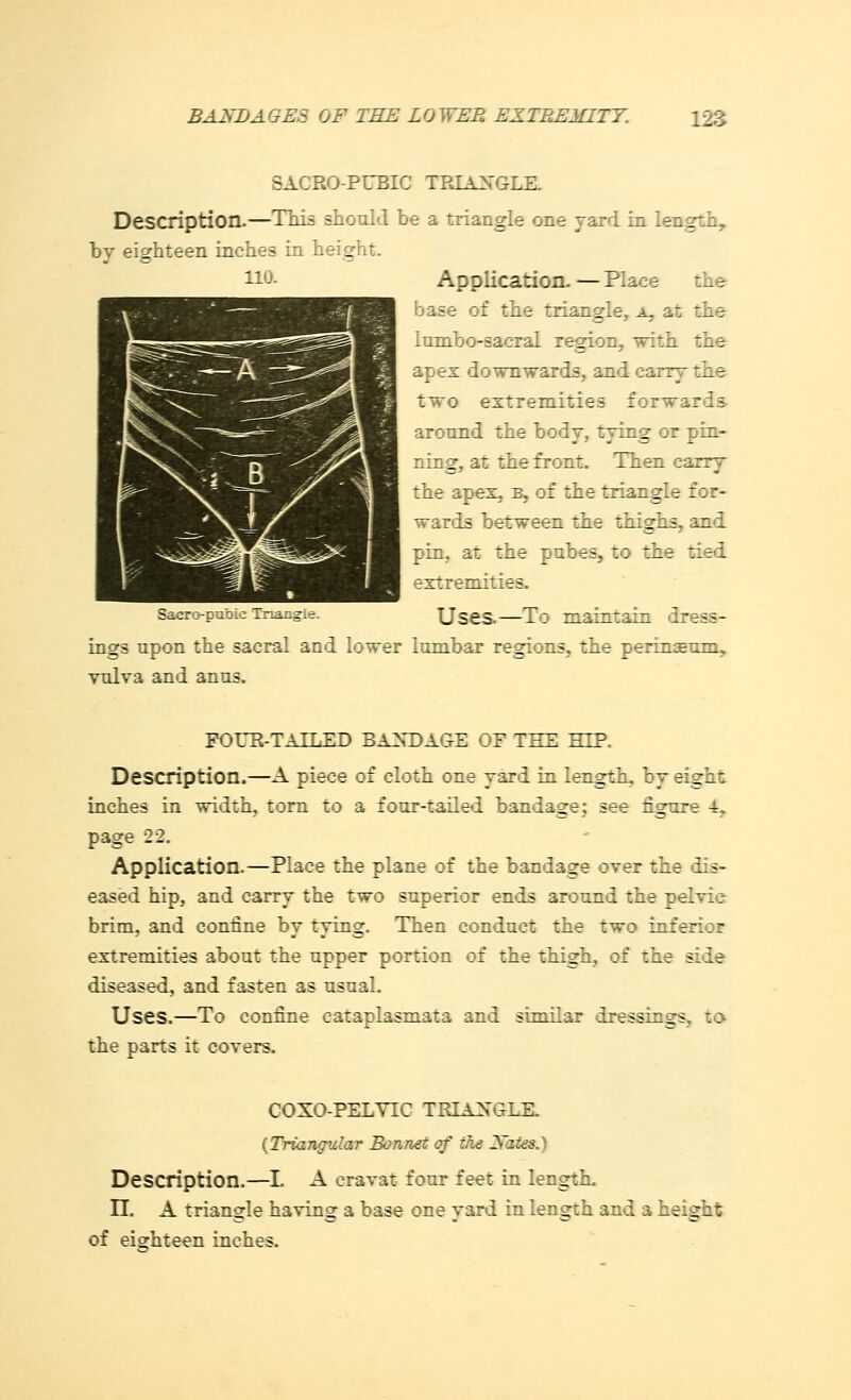 110. SACRO-PUBIC TRIANGLE. Description.—This should be a triangle one yard in length, by eighteen inches in height. Application. — Place the base of the triangle, a, at the lumbo-sacral region, with the apex downwards, and carry the two extremities forwards around the body, tying or pin- ning, at the front. Then carry the apex, b, of the triangle for- wards between the thighs, and pin, at the pubes, to the tied extremities. Sacro-pubic Triangle. Uses.—To maintain dress- ings upon the sacral and lower lumbar regions, the perinasum,. vulva and anus. FOUR-TAILED BANDAGE OF THE HIP. Description.—A piece of cloth one yard in length, by eight inches in width, torn to a four-tailed bandage; see figure 4y page 22. Application.—Place the plane of the bandage over the dis- eased hip, and carry the two superior ends around the pelvic brim, and confine by tying. Then conduct the two inferior extremities about the upper portion of the thigh, of the side diseased, and fasten as usual. Uses.—To confine eataplasmata and similar dressings, to the parts it covers. COXO-PELYIC TRIANGLE. (Triangular Bonnet of the Sates.) Description.—I. A cravat four feet in length. II. A triangle having a base one yard in length and a height of eighteen inches.