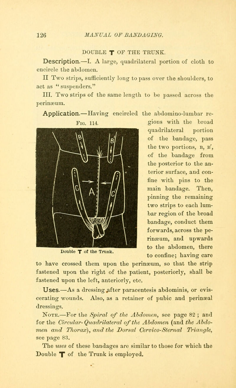 DOUBLE T OF THE TRUNK. Description.—I. A large, quadrilateral portion of cloth to encircle the abdomen. II Two strips, sufficiently long to pass over the shoulders, to act as  susjDenders. III. Two strips of the same length to be passed across the perinseum. Application.—Having encircled the abdomino-lumbar re- Fig. 114. gions with the broad quadrilateral portion of the bandage, pass the two portions, b, b', of the bandage from the posterior to the an- terior surface, and con- fine with pins to the main bandage. Then, pinning the remaining two strips to each lum- bar region of the broad bandage, conduct them forwards, across the pe- rinseuin, and upwards to the abdomen, there to confine; having care to have crossed them upon the perinoeurn, so that the strip fastened upon the right of the patient, posteriorly, shall be fastened upon the left, anteriorly, etc. Uses.—As a dressing jifter paracentesis abdominis, or evis- cerating wounds. Also, as a retainer of pubic and perineal dressings. Note.—For the Sjyiral of the Abdomen, see page 82 ; and for the Circular-Quadrilateral of the Abdomen (and the Abdo- men and Thorax), and the Dorsal Cervico-Sternal Triangle, see page 83. The uses of these bandages are similar to those for which the Double X °f tne Trunk is employed. Double T of the Trunk.
