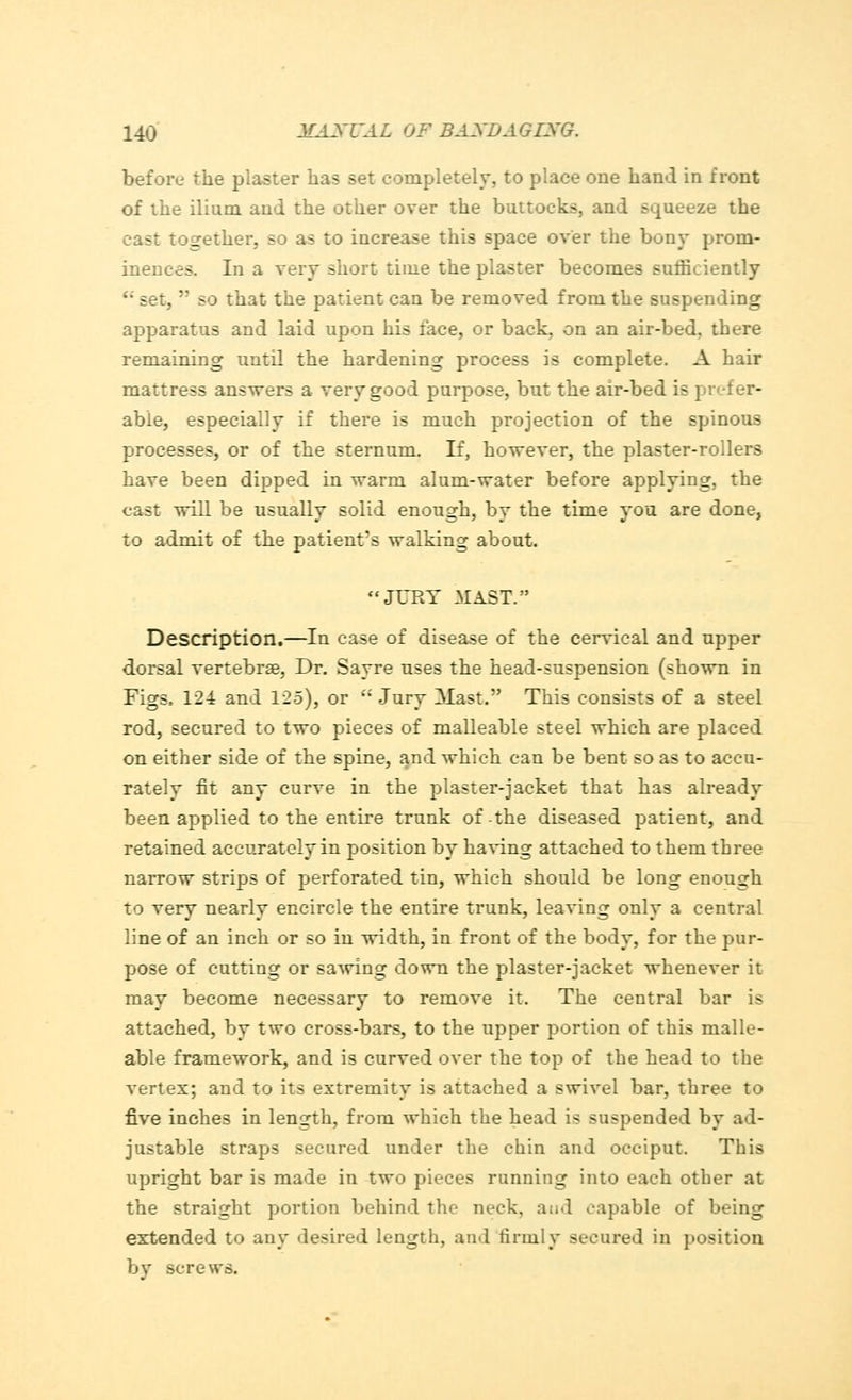 before the plaster has set completely, to place one hand in front of the ilium and the other over the buttocks, and squeeze the cast together, so as to increase this space over the bony prom- inences. In a very short time the plaster becomes sufficiently ''set, so that the patient can be removed from the suspending apparatus and laid upon his face, or back, on an air-bed. there remaining until the hardening process is complete. A hair mattress answers a very good purpose, but the air-bed is prefer- able, especially if there is much projection of the spinous processes, or of the sternum. If, however, the plaster-rollers have been dipped in warm alum-water before applying, the cast will be usually solid enough, by the time you are done, to admit of the patient's walking about. JURY MAST. Description.—In case of disease of the cervical and upper dorsal vertebrae, Dr. Sayre uses the head-suspension (shown in Figs, 124 and 125), or Jury Mast. This consists of a steel rod, secured to two pieces of malleable steel which are placed on either side of the spine, and which can be bent so as to accu- rately fit any curve in the plaster-jacket that has already been applied to the entire trunk of-the diseased patient, and retained accurately in position by having attached to them three narrow strips of perforated tin, which should be long enough to very nearly encircle the entire trunk, leaving only a central line of an inch or so in width, in front of the body, for the pur- pose of cutting or sawing down the plaster-jacket whenever it may become necessary to remove it. The central bar is attached, by two cross-bars, to the upper portion of this malle- able framework, and is curved over the top of the head to the vertex; and to its extremity is attached a swivel bar, three to five inches in length, from which the head is suspended by ad- justable straps secured under the chin and occiput. This upright bar is made in two pieces running into each other at the straight portion behind the neck, aud capable of being extended to any desired length, and firmly secured in position by screws.