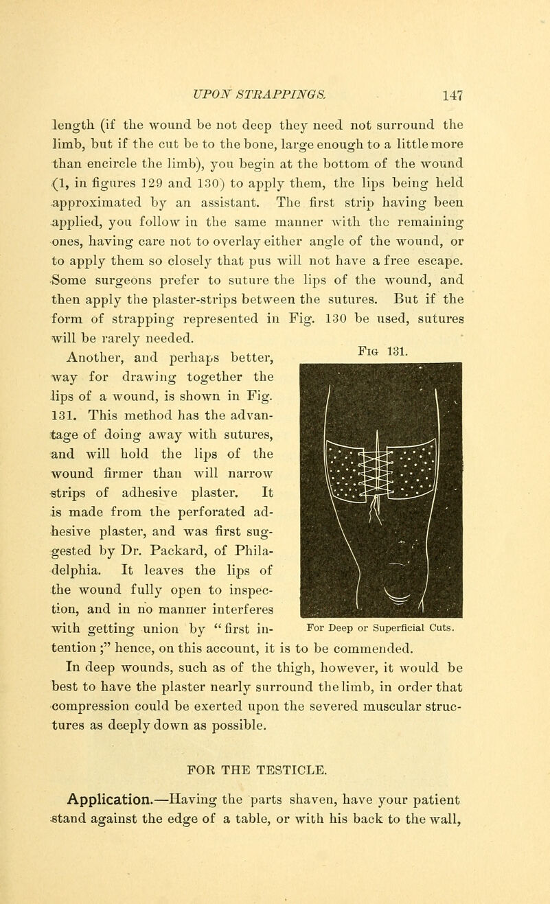 Fig 131. length (if the wound be not deep they need not surround the limb, but if the cut be to the bone, large enough to a little more than encircle the limb), you begin at the bottom of the wound (1, in figures 129 and 130) to apply them, the lips being held -approximated by an assistant. The first strip having been applied, you follow in the same manner with the remaining ones, having care not to overlay either angle of the wound, or to apply them so closely that pus will not have a free escape. Some surgeons prefer to suture the lips of the wound, and then apply the plaster-strips between the sutures. But if the form of strapping represented in Fig. 130 be used, sutures will be rarely needed. Another, and perhaps better, way for drawing together the lips of a wound, is shown in Fig. 131. This method has the advan- tage of doing away with sutures, and will hold the lips of the wound firmer than will narrow strips of adhesive plaster. It is made from the perforated ad- hesive plaster, and was first sug- gested by Dr. Packard, of Phila- delphia. It leaves the lips of the wound fully open to inspec- tion, and in no manner interferes with getting union by  first in- For Deep or Superficial Cuts. tention ; hence, on this account, it is to be commended. In deep wounds, such as of the thigh, however, it would be best to have the plaster nearly surround the limb, in order that compression could be exerted upon the severed muscular struc- tures as deeply down as possible. FOR THE TESTICLE. Application.—Having the parts shaven, have your patient «tand against the edge of a table, or with his back to the wall,