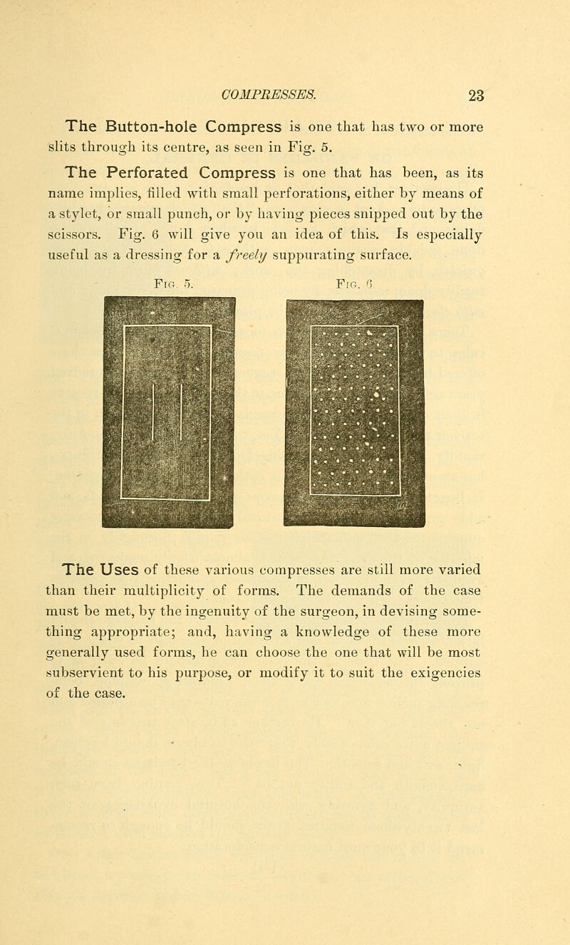 The Button-hole Compress is one that has two or more slits through its centre, as seen in Fig. 5. The Perforated Compress is one that has been, as its name implies, filled with small perforations, either by means of a stylet, or small punch, or by having pieces snipped out by the scissors. Fig. 6 will give you an idea of this. Is esj)ecially useful as a dressing for a freely supj)urating surface. FrG. 5. Fro. 0^ The Uses of these various compresses are still more varied than their multiplicity of forms. The demands of the case must be met, by the ingenuity of the surgeon, in devising some- thing appropriate; and, having a knowledge of these more generally used forms, he can choose the one that will be most subservient to his purpose, or modify it to suit the exigencies of the case.