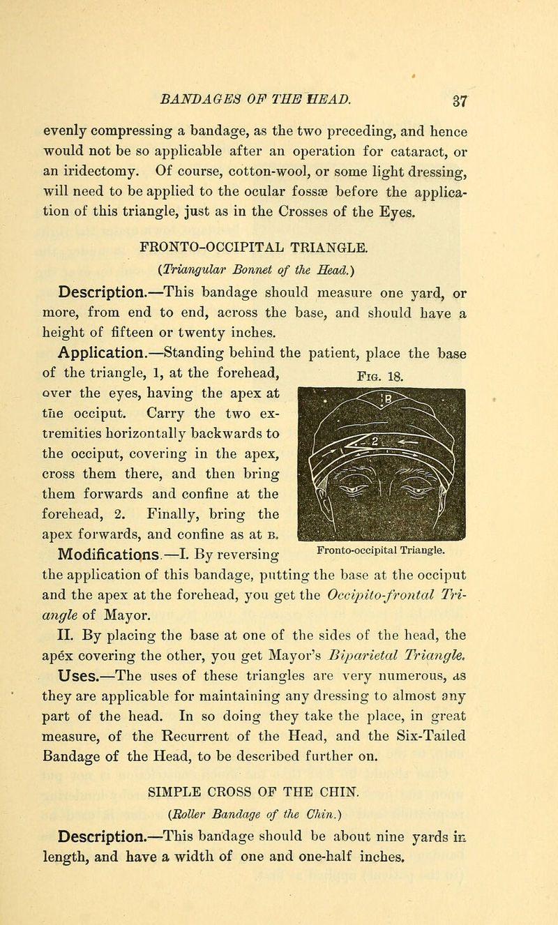 evenly compressing a bandage, as the two preceding, and hence would not be so applicable after an operation for cataract, or an iridectomy. Of course, cotton-wool, or some light di-essing, will need to be applied to the ocular fossae before the applica- tion of this triangle, just as in the Crosses of the Eyes. FRONTO-OCCIPITAL TRIANGLE. {Triangular Bonnet of the Head.) Description.—This bandage should measure one yard, or more, from end to end, across the base, and should have a height of fifteen or twenty inches. Application.—Standing behind the patient, place the base of the triangle, 1, at the forehead, Yi&. 18. over the eyes, having the apex at tlie occiput. Carry the two ex- tremities horizontally backwards to the occiput, covering in the apex, cross them there, and then bring them forwards and confine at the forehead, 2. Finally, bring the apex forwards, and confine as at b. Modifications—I. By reversing Fronto-occipital Triangle, the application of this bandage, piitting the base at the occiput and the apex at the forehead, you get the Occiinto-frontal Tri- angle of Mayor. 11. By placing the base at one of the sides of the head, the apex covering the other, you get Mayor's Biparietal Triangle. Uses.—The uses of these triangles are very numerous, as they are applicable for maintaining any dressing to almost any part of the head. In so doing they take the place, in great measure, of the Recurrent of the Head, and the Six-Tailed Bandage of the Head, to be described further on. SIMPLE CROSS OF THE CHIN. (Boiler Bandage of the Chin.) Description.—This bandage should be about nine yards in length, and have a width of one and one-half inches.