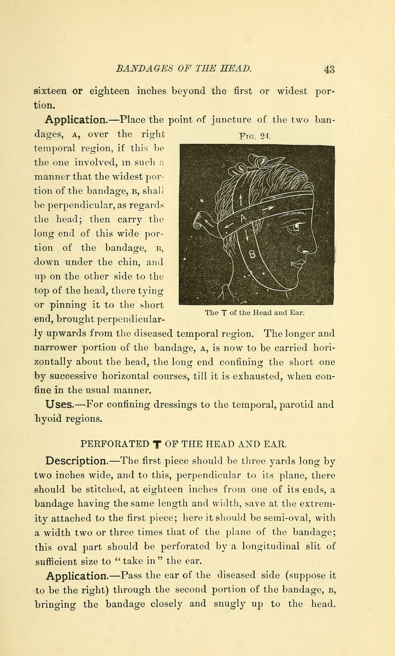 sixteen or eighteen inches beyond the first or widest por- tion. Application.—Place the point of juncture of the two ban- dages, A, over the right Yjg. 24. temporal region, if this be the one involved, m such n manner that the widest por- tion of the bandage, b, shall be perpendicular, as regards the head; then carry the long end of this wide por- tion of the bandage, b, down under the chin, and up on the other side to the top of the head, there tying or pinning it to the .short end, brought perpendicular- ly upwards from the diseased temporal region. The longer and narrower portion of the bandage, a, is now to be carried hori- zontally about the head, the long end confining the short one by successive horizontal courses, till it is exhausted, when con- fine in the usual manner. Uses.—For confining dressings to the temporal, parotid and hyoid regions. The T of the Head and Ear. PERFORATED T OF THE HEAD AND EAR. Description.—The first piece should be three yards long by two inches wide, and to this, perpendicular to its plane, there should be stitched, at eighteen inches from one of its ends, a bandage having the same length and width, save at the extrem- ity attached to the first piece; here it should be semi-oval, with a width two or three times that of the plane of the bandage; this oval part should be perforated by a longitudinal slit of sufiicient size to take in the ear. Application.—Pass the ear of the diseased side (suppose it to be the right) through the second portion of the bandage, b, bringing the bandage closely and snugly up to the head.