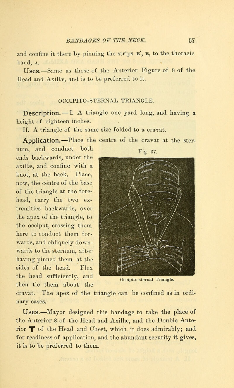 and confine it there by pinning the strips e', b, to the thoracic band, a. Uses.—Same as those of the Anterior Figure of 8 of the Head and Axillee, and is to be preferred to it. OCCIPITO-STERNAL TRIANGLE. Description. — I. A triangle one yard long, and having a heio-ht of eighteen inches. II. A triangle of the same size folded to a cravat. Application.—Place the centre of the cravat at the ster- num, and conduct both -p. g^ ends backwards, under the axillse, and confine with a knot, at the back. Place, now, the centre of the base of the triangle at the fore- head, carry the two ex- tremities backwards, over the apex of the triangle, to the occiput, crossing them here to conduct them for- wards, and obliquely down- wards to the sternum, after having pinned them at the sides of the head. Flex the head sufficiently, and then tie them about the cravat. The apex of the triangle can be confined as in ordi- nary cases. Uses.—Mayor designed this bandage to take the place of the Anterior 8 of the Head and Axillae, and the Double Ante- rior TT of the Head and Chest, which it does admirably; and for readiness of application, and the abundant security it gives, it is to be pref ei'red to them. Occipito-sternal Triangle.