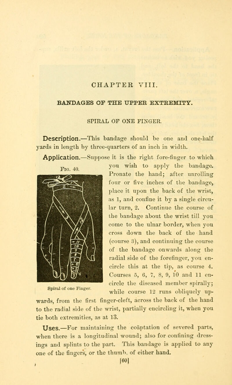 CHAPTER YIII, BANDAGES OF THE UPPER EXTREMITY. SPIRAL OF ONE FINGER. Description.—This bandage should be one and one-half yards in length by three-quarters of an inch in width. Application.—Sujapose it is the right fore-finger to which you wish to apply the bandage. Pronate the hand; after unrolling four or five inches of the bandage, place it upon the back of the wrist, as 1, and confine it by a single circu- lar turn, 2. Continue the course of the bandage about the wrist till you come to the ulnar border, when you cross down the back of the hand (course 3), and continuing the course of the bandage onwards along the radial side of the forefinger, you en- circle this at the tip, as course 4. Courses 5, 6, 7, 8, 9, 1*0 and 11 en- circle the diseased member spirally; wards, from the first finger-cleft, across the back of the hand to the radial side of the wrist, partially encircling it, when you tie both extremities, as at l3. Uses.—For maintaining the coaptation of severed parts, when there is a longitudinal wound; also for confining dress- ings and splints to the part. This bandage is applied to any one of the fingers, or the thumb, of either baud. |60| Spiral of one Finger.