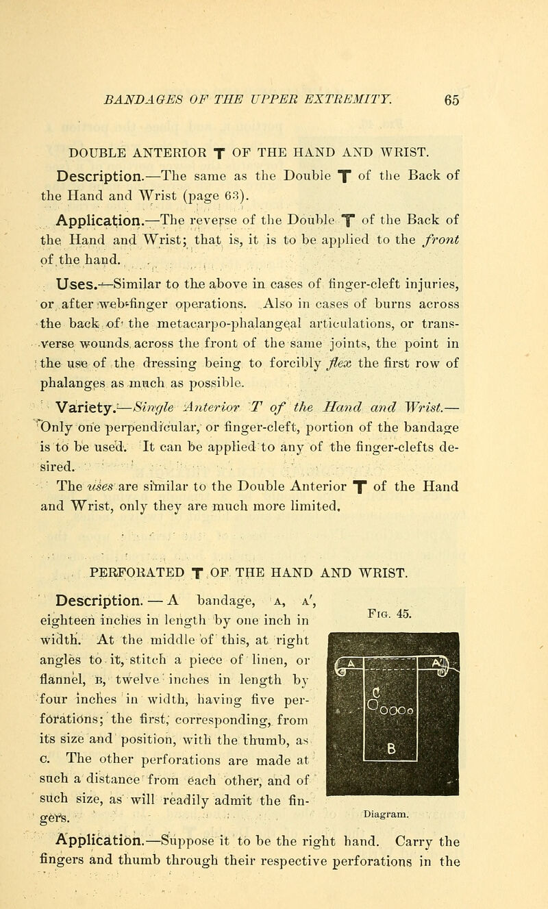 DOUBLE ANTERIOR T OF THE HAND AND WRIST. Description.—The same as the Double X of the Back of the Hand and Wrist (page 6-3). Applicat;ion.—The reverse of tlie Double f of the Back of the Hand and Wrist; that is, it is to be applied to the front of,the hand. , . Uses.-'—Similar to the above in cases of finger-cleft injuries, or after :webt-finger operations. Also in cases of burns across the back of' the metacarpo-phalang^al articulations, or trans- verse wounds, across the front of the same joints, the point in ; the use of the dressing being to forcibly flex the first row of phalanges as much as possible. Variety.^^—Single ■Anterior T of the Hand and Wrist.— Only one pei'pendicular, or finger-cleft, portion of the bandage is to be useH'. It can be applied to any of the finger-clefts de- '■Sired..-:'' ' - ' The wses are siinilar to the Double Anterior X of the Hand and Wrist, only they are much more limited. PERFORATED T OF THE HAND AND WRIST. Fig. 45. Description.—A bandage, a, a'. eighteen inches in length by one inch in width. At the middle of this, at right angles to it, stitch a piece of linen, or flannel, fe, twelve' inches in length by •four incbes in width, having five per- f6i'ati()ns; the first; corresponding, from its size and position, with the thumb, as c. The other perforations are made at such a distance from each other, and of such size, as will readily admit the fin- geft. ■ Application.—Suppose it to be the right hand. Carry the fingers and thumb through their respective perforations in the Diagram.