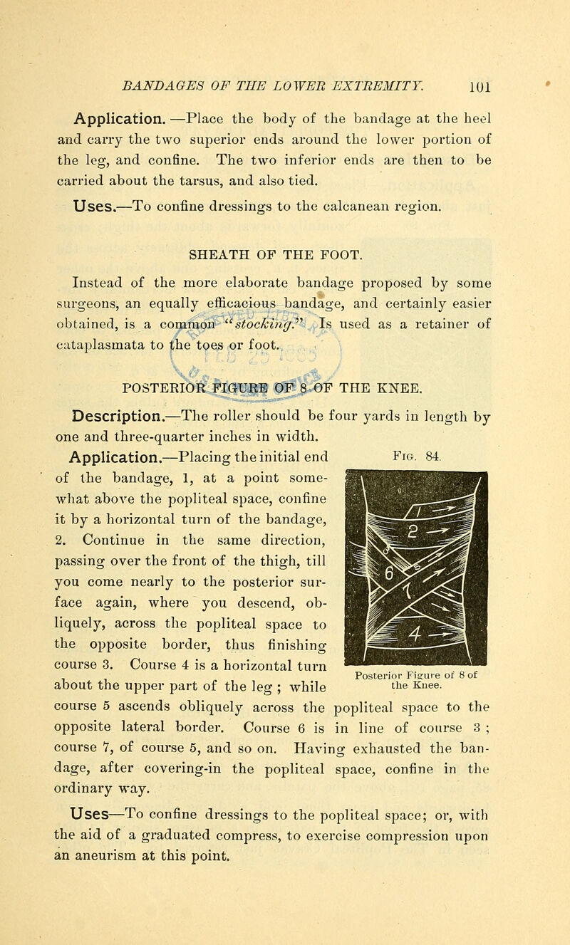 Application. —Place the body of the bandage at the heol and carry the two superior ends around the lower portion of the leg, and confine. The two inferior ends are then to be carried about the tarsus, and also tied. Uses.—To confine dressings to the calcanean region. SHEATH OF THE FOOT. Instead of the more elaborate bandage proposed by some surgeons, an equally efficacious bandage, and certainly easier obtained, is a common siocTcingy Is used as a retainer of cataplasmata to the toes or foot. Fig. 84. POSTERIOR FIGURE OF 8 OF THE KNEE. Description.—The roller should be four yards in length by one and three-quarter inches in width. Application.—Placing the initial end of the bandage, 1, at a point some- what above the popliteal space, confine it by a horizontal turn of the bandage, 2. Continue in the same direction, passing over the front of the thigh, till you come nearly to the posterior sur- face again, where you descend, ob- liquely, across the popliteal space to the opposite border, thus finishing course 3. Course 4 is a horizontal turn about the upper part of the leg ; while course 5 ascends obliquely across the popliteal space to the opposite lateral border. Course 6 is in line of course 3 ; course 7, of course 5, and so on. Having exhausted the ban- dage, after covering-in the popliteal space, confine in the ordinary way. Uses—To confine dressings to the popliteal space; or, with the aid of a graduated compress, to exercise compression upon an aneurism at this point. Posterioi- Figrure of 8 of the Knee.