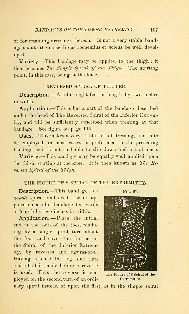or for retaining dressings thereon. Is not a very stable band- age should the musculi gastrocnemius et soleus be well devel- oped. Variety.—This bandage may be applied to the thigh ; it then becomes T/ie Simple Spiral of the Thigh. The starting point, in this case, being at the knee. REVERSED SPIRAL OF THE LEG. Description.—A roller eight feet in length by two inches in width. Application.—This is but a part of the bandage described under the head of The Reversed Spiral of the Inferior Extrem- ity, and will be sufficiently described when treating at that bandage. See figure on i^age 110. Uses.—This makes a very stable sort of dressing, and is to be employed, in most cases, in preference to the preceding bandage, as it is not so liable to slip down and out of place. Variety.—This bandage may be equally well applied upon the thigh, starting at the knee. It is then known as The Re- versed Spiral of the Thigh. THE FIGURE OF 8 SPIRAL OP THE EXTREMITIES. Fig. 91. Description.—This bandage is a double spiral, and needs for its ap- plication a roller-bandage ten yards in length by two inches in width. Application. — Place the initial end at the roots of the toes, confin- ing by a single spiral, turn about the foot, and cover the foot as in the Spiral of the Inferior Extrem- ity, by reverses and figures-of-8. Having reached the leg, one turn and a half is made before a reverse is used. Thus the reverse is em- ployed on the second turn of an ordi- nary spiral instead of upon the first, as in the simple spiral The Figure of 8 Spiral of the Extremities.