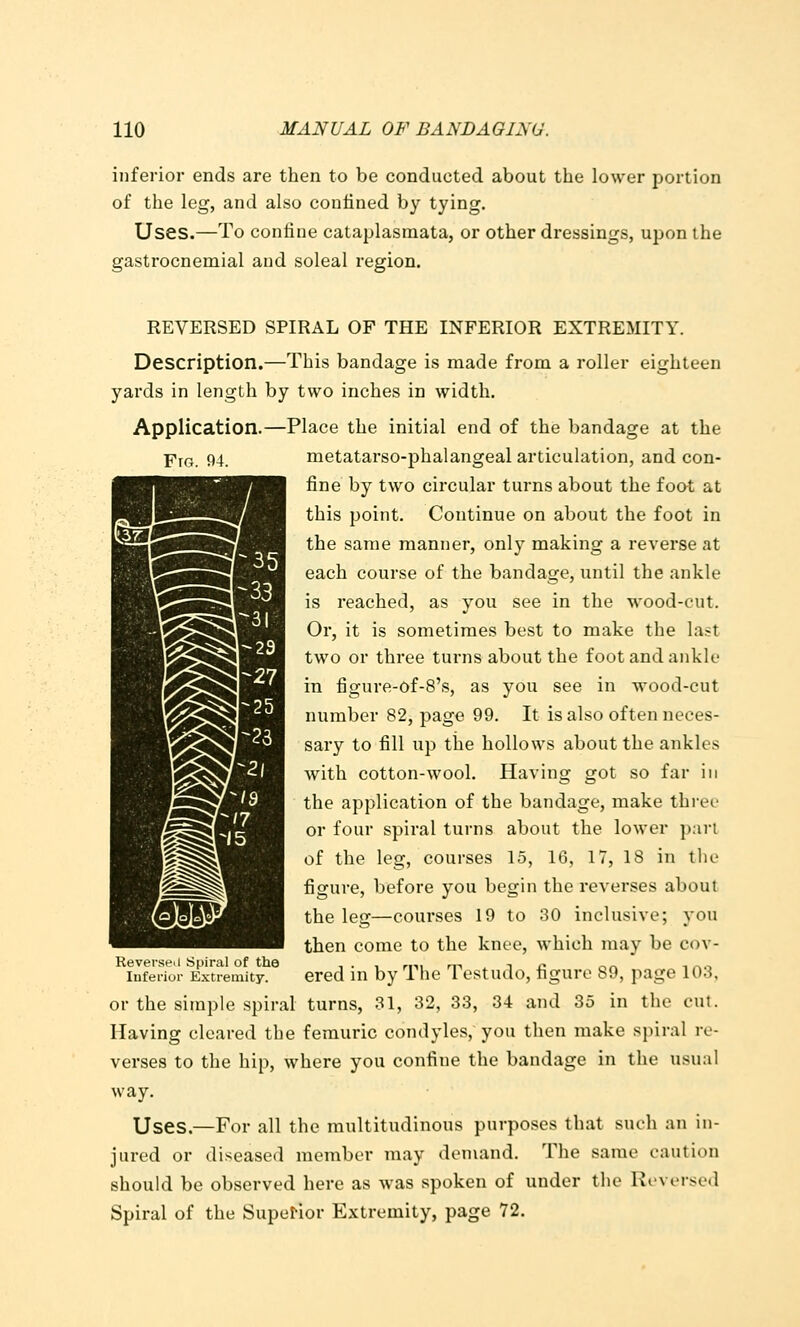 inferior ends are then to be conducted about the lower portion of the leg, and also confined by tying. Uses.—To confine cataplasmata, or other dressings, upon the gastrocnemial and soleal region. REVERSED SPIRAL OF THE INFERIOR EXTREMITY. Description.—This bandage is made from a roller eighteen yards in length by two inches in width. Application.—Place the initial end of the bandage at the Fig. 94. metatarso-phalangeal articulation, and con- fine by two circular turns about the foot at this point. Continue on about the foot in the same manner, only making a reverse at each course of the bandage, until the ankle is reached, as you see in the wood-cut. Or, it is sometimes best to make the last two or three turns about the foot and aiikle in figure-of-8's, as you see in wood-cut number 82, page 99. It is also often neces- sary to fill up tiie hollows about the ankles with cotton-wool. Having got so far in the application of the bandage, make three or four spiral turns about the lower part of the leg, courses 15, 16, 17, 18 in the figure, before you begin the reverses about the leg—courses 19 to 30 inclusive; you then come to the knee, which may be cov- Reverse.i Spiral of the .. , „-ii m .. i i: or, nno Inferior Extremity. ered in by Ihe 1 estudo, tiguro b9, page 103, or the simple spiral turns, 31, 32, 33, 34 and 35 in the cut. Having cleared the femuric condyles, you then make spiral re- verses to the hip, where you confine the bandage in the usual way. Uses.—For all the multitudinous purposes that such an in- jured or diseased member may demand. The same caution should be observed here as was spoken of under the Ki'versed Spiral of the Superior Extremity, page 72.