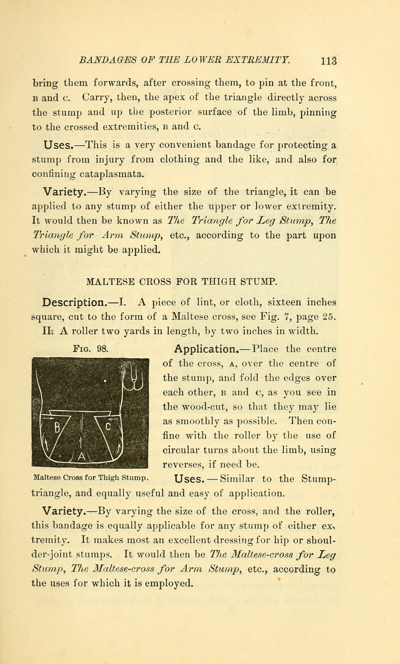 bring them forwards, after crossing them, to pin at the front, B and c. Carry, then, the apex of the triangle directly across the stumj) and up the posterior surface of the limb, pinning to the crossed extremities, b and c. Uses.—This is a very convenient bandage for protecting a stump from injury from clothing and the like, and also for confining cataplasmata. Variety.—By varying the size of the triangle, it can be applied to any stump of either the upper or lower extremity. It would then be known as The Triangle for Leg Stuvip, The Triangle for Arm Stump, etc., according to the part upon which it might be applied. MALTESE CROSS FOR THIGH STUMP. Description.—I. A piece of lint, or cloth, sixteen inches square, cut to the form of a Maltese cross, see Fig. 7, page 25. It A roller two yards in length, by two inches in width. Fig. 98. Application,—Place the centre of the cross, a, over the centre of the stump, and fold the edges over each other, b and c, as you see in the wood-cut, so that they may lie as smoothly as possible. Then con- fine with the roller by the use of circular turns about the limb, using reverses, if need be. Maltese Cross for Thigh stump. Uscs. — Similar to the Stump- triangle, and equally useful and easy of application. Variety.-—By varying the size of the cross, and the roller, this bandage is equally applicable for any stump of either ex^ tremity. It makes most an excellent dressing for hip or shoul- dei'-joint stumps. It would then be The Maltese-cross for Leg Stimip, The 3faltese-cross for Arm Stump, etc., according to the uses for which it is employed.